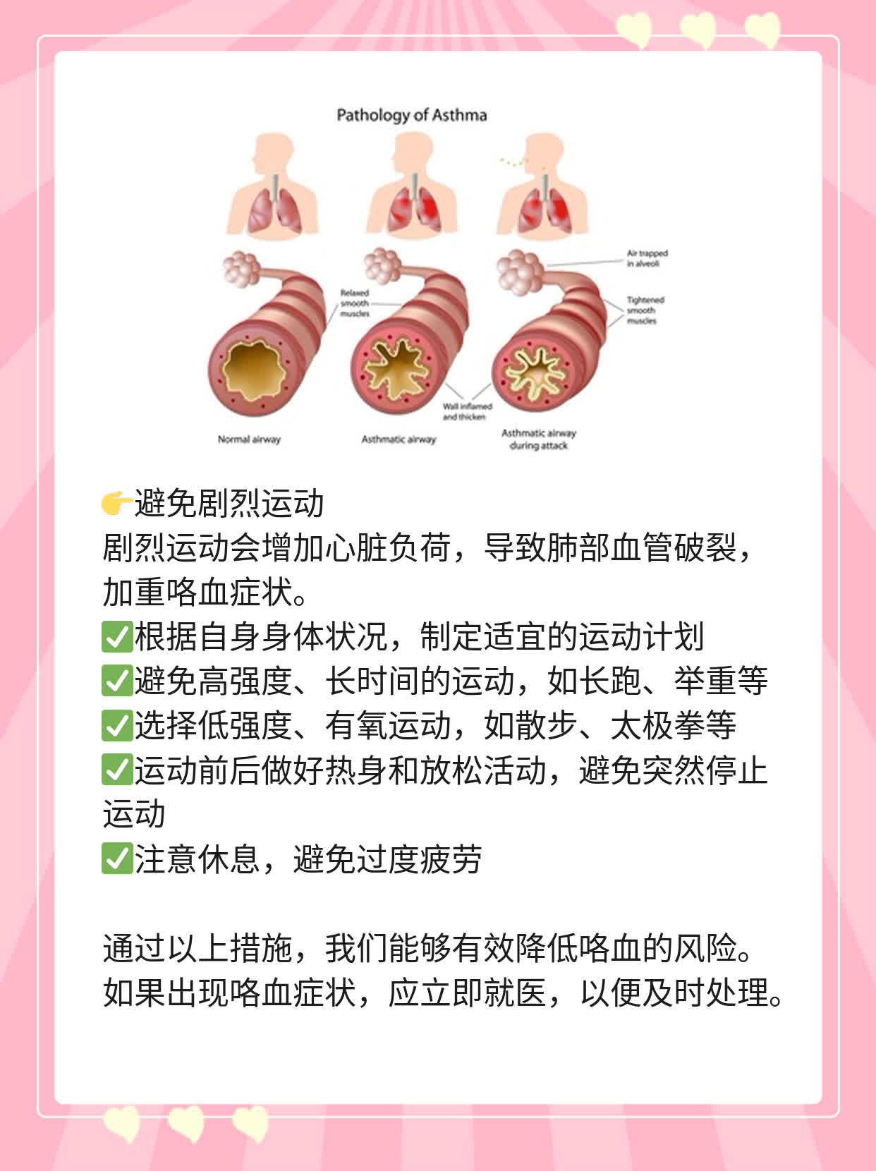 「咯血」：每日咯血量超多少算“大量”？