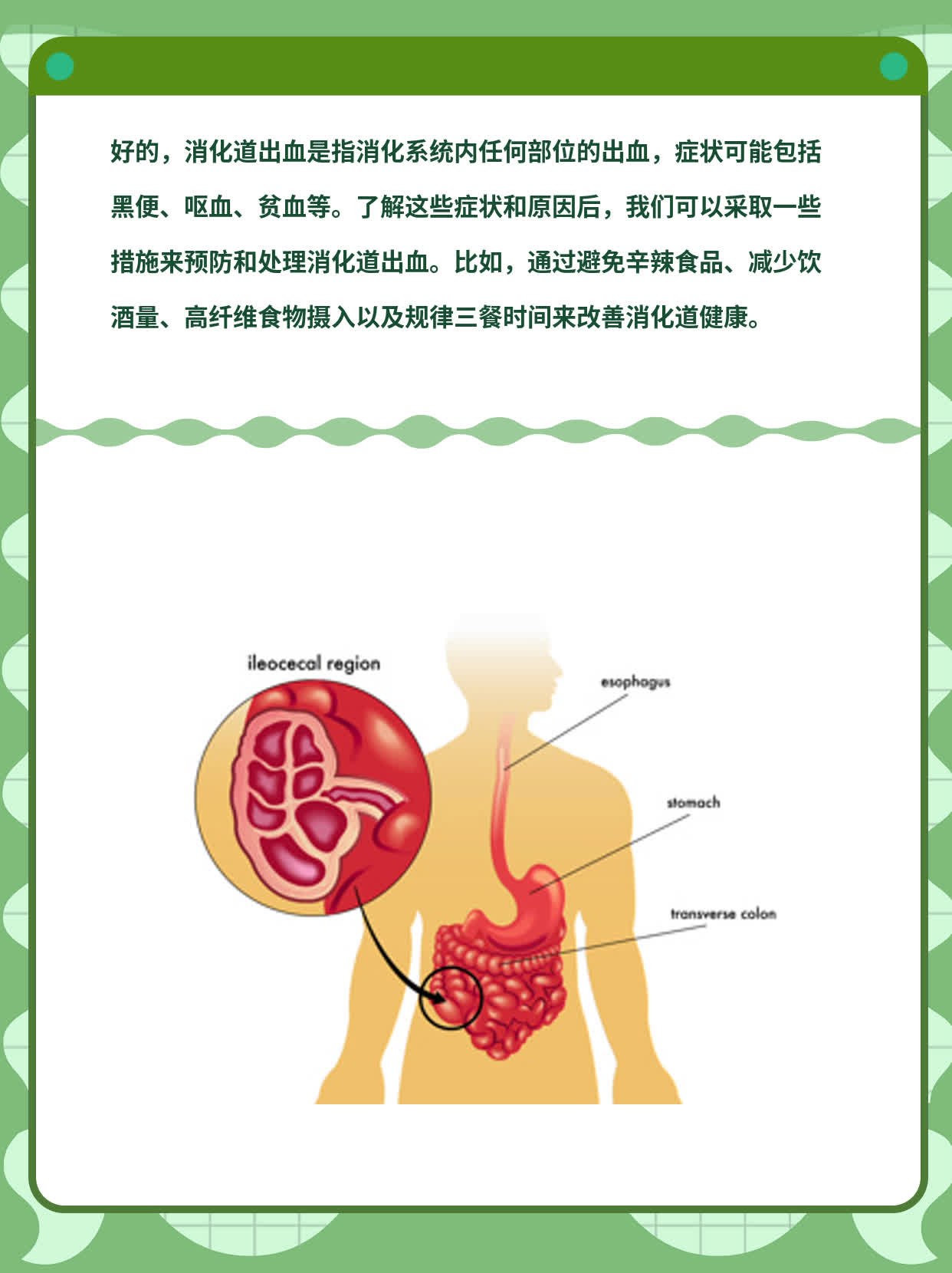 「揭秘」消化道出血的症状、原因及处理方法