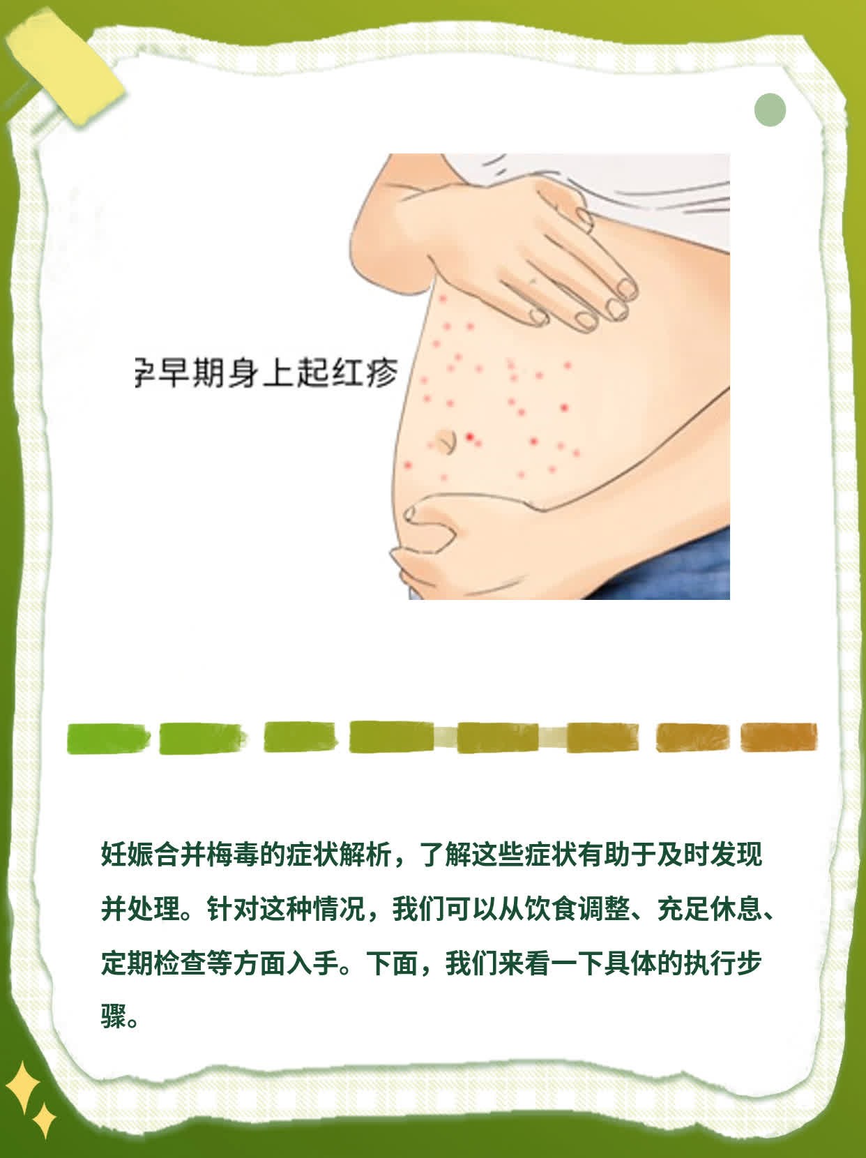 「孕期梅毒」：妊娠合并梅毒的症状解析