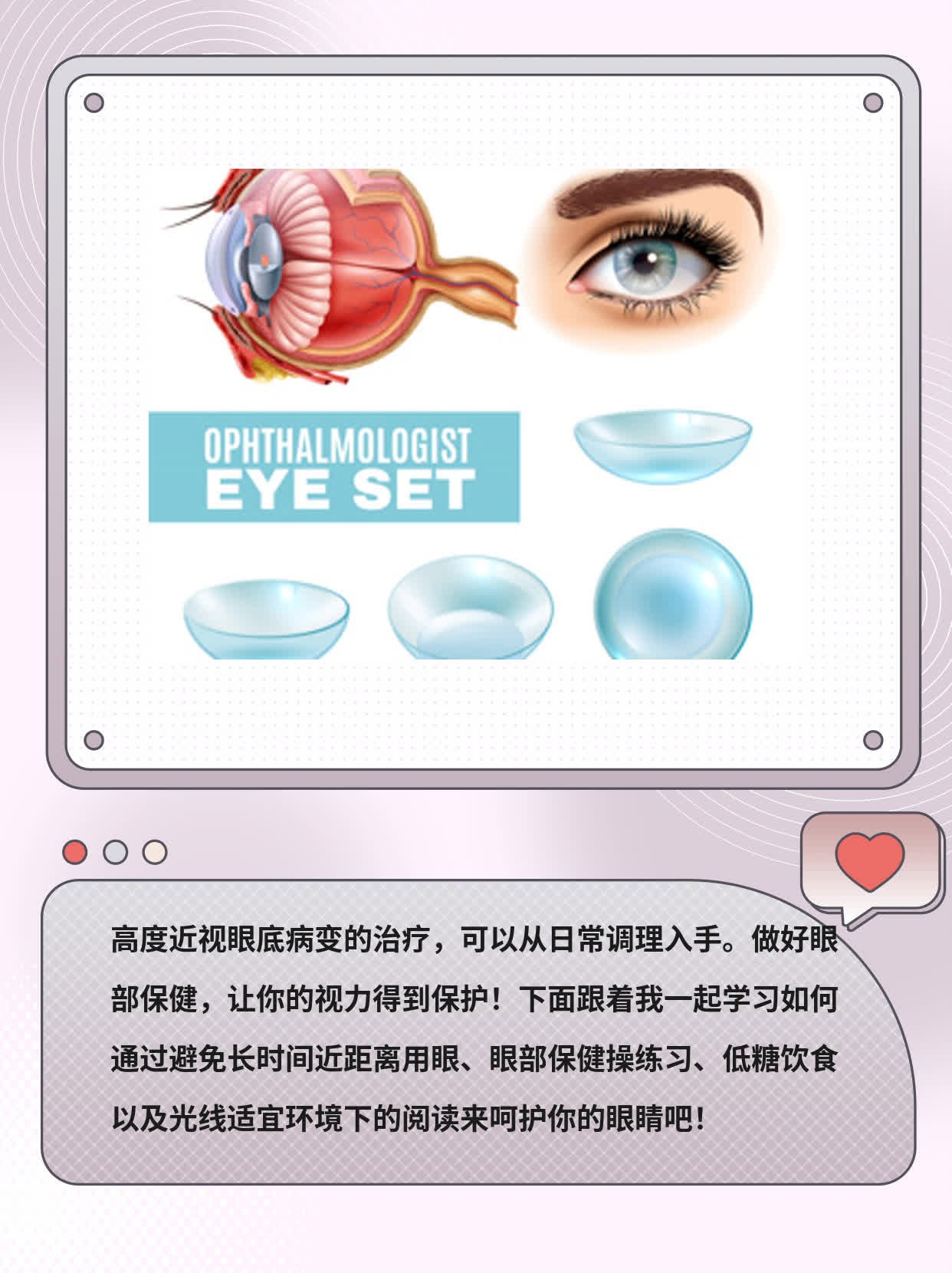「近视眼底病变」治疗攻略：高度近视患者的救星！