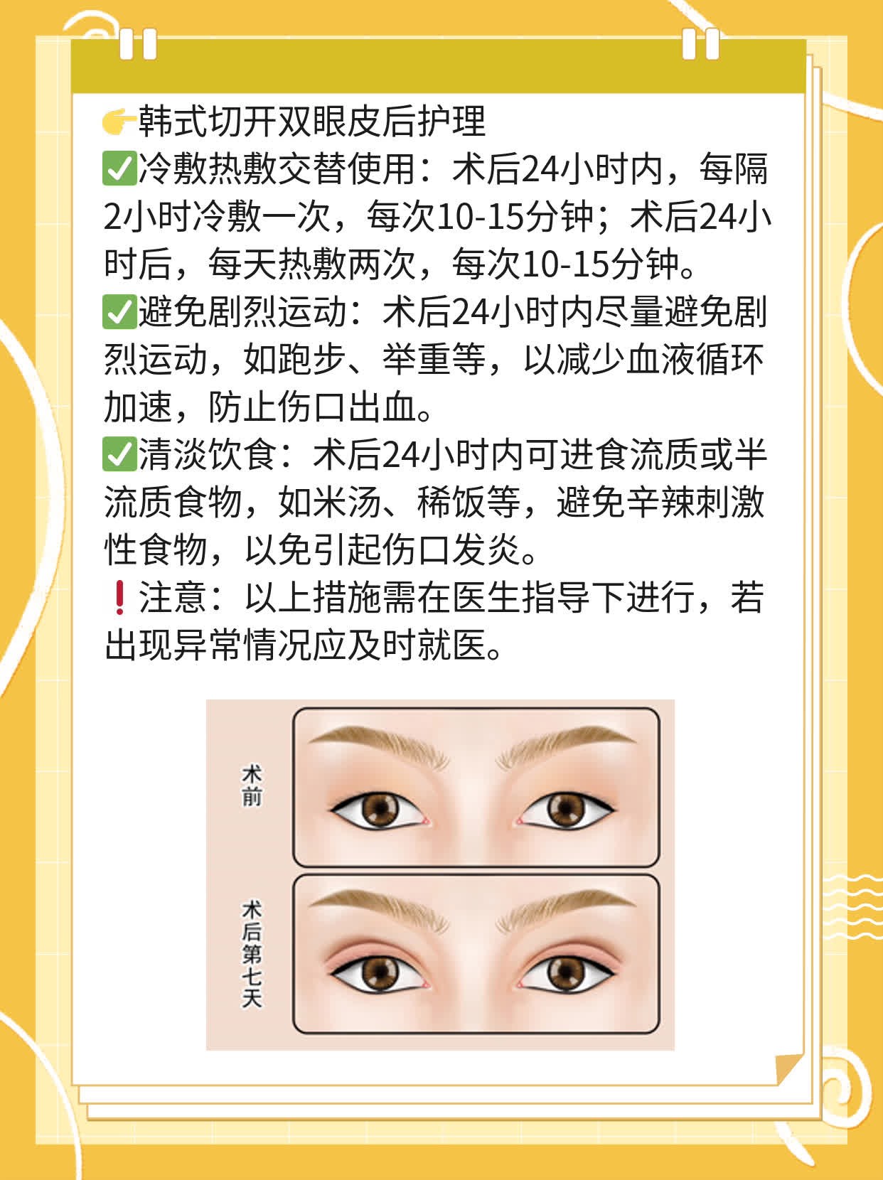 「双眼皮手术」 韩式切开 vs 全切，你知道的区别吗？