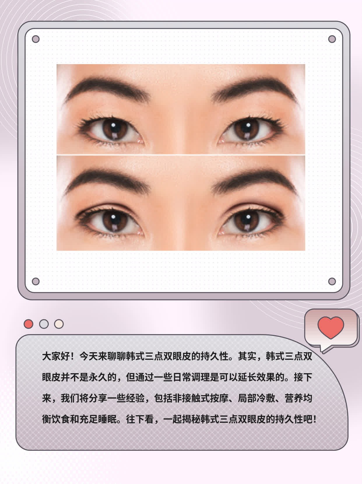 揭秘：韩式三点双眼皮能持久吗？经验分享！
