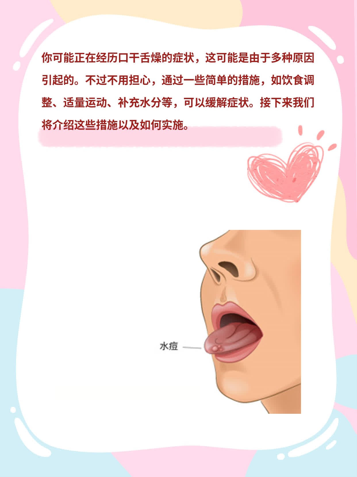 「口干舌燥」背后的原因及药物解救方案