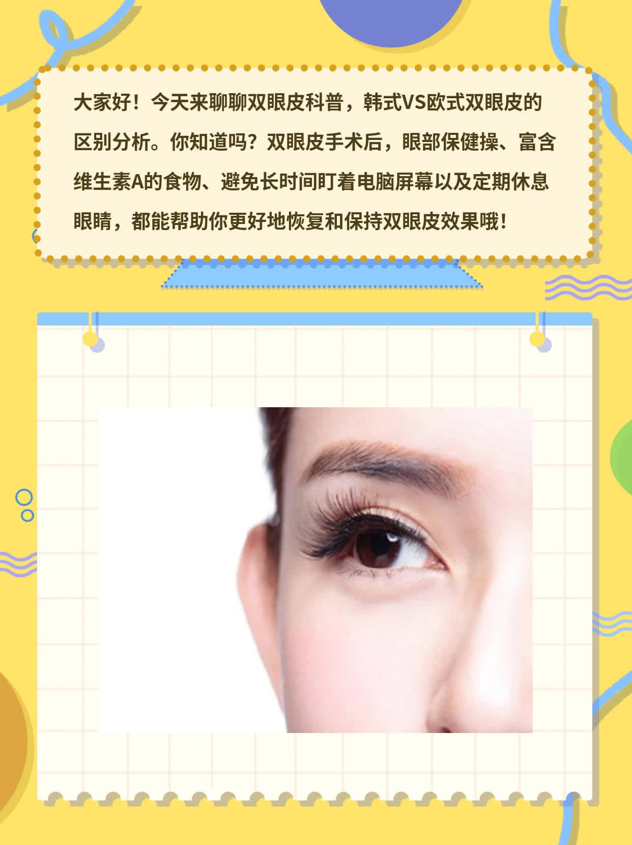 「双眼皮科普」 韩式VS欧式双眼皮的区别分析