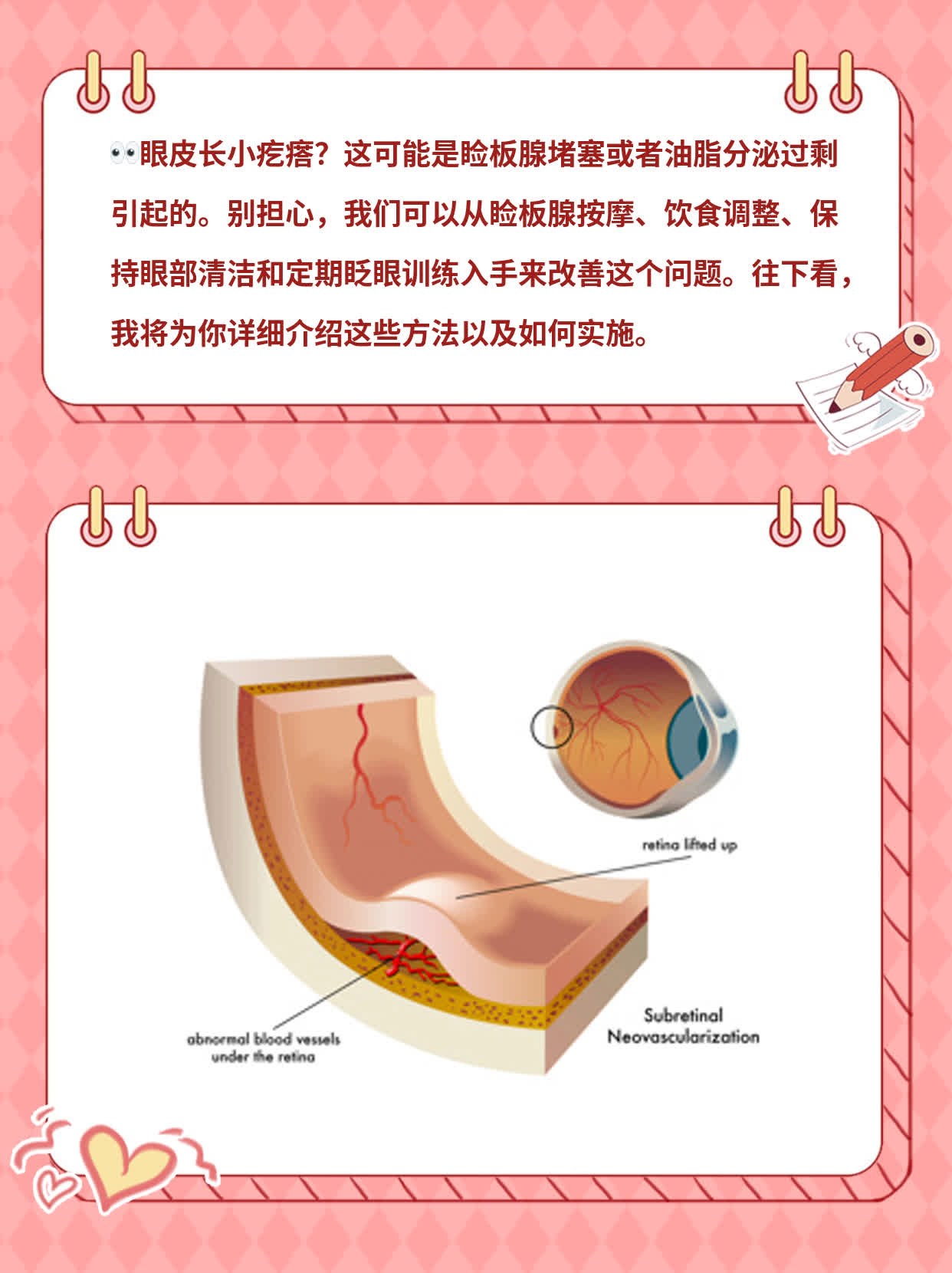 「眼皮长小疙瘩」原因揭秘！