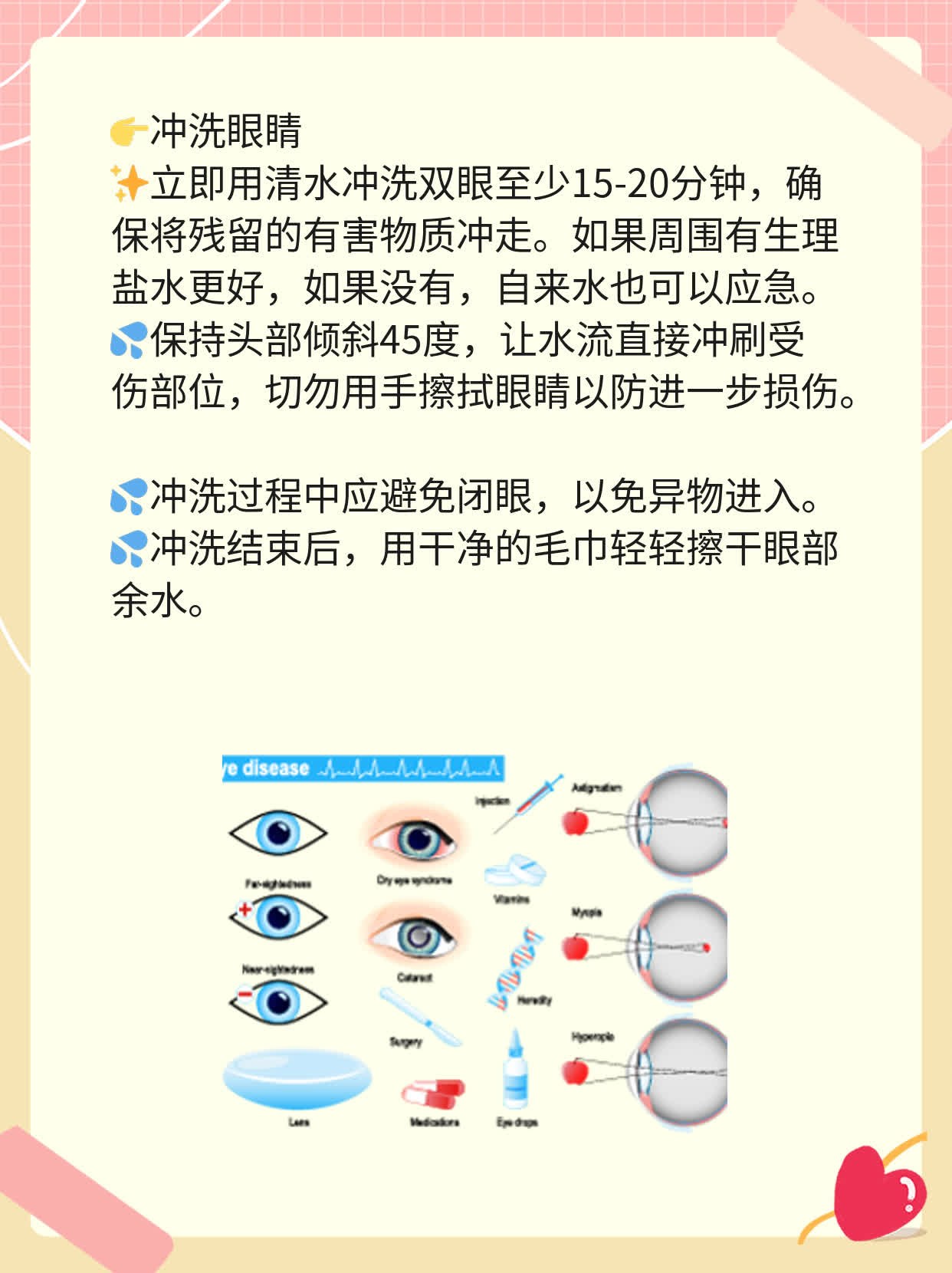 「急救」：应对电焊光灼伤双眼的妙招！