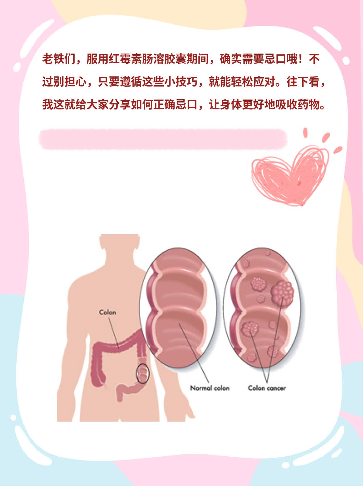 红霉素肠溶胶囊需忌口吗？