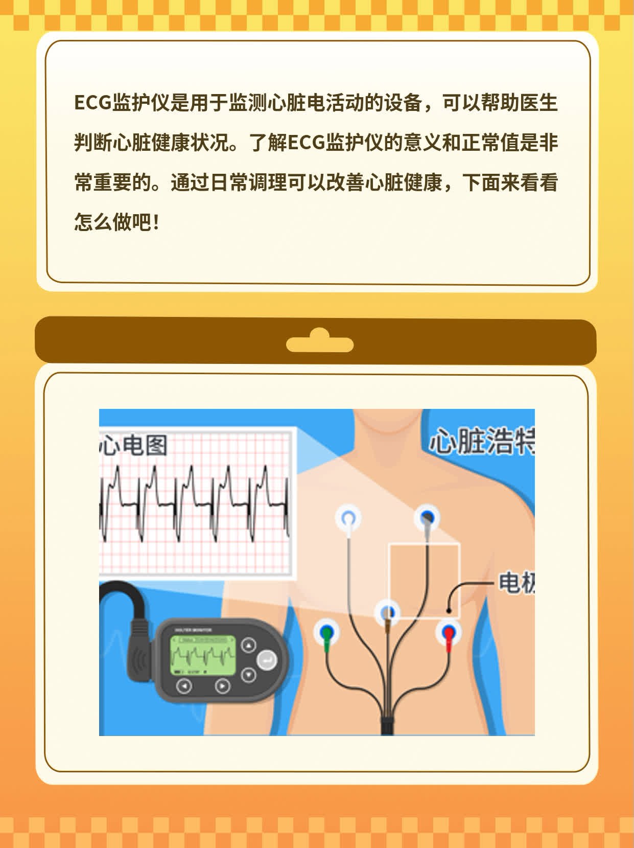 「ECG监护仪」解读：意义&正常值探秘！