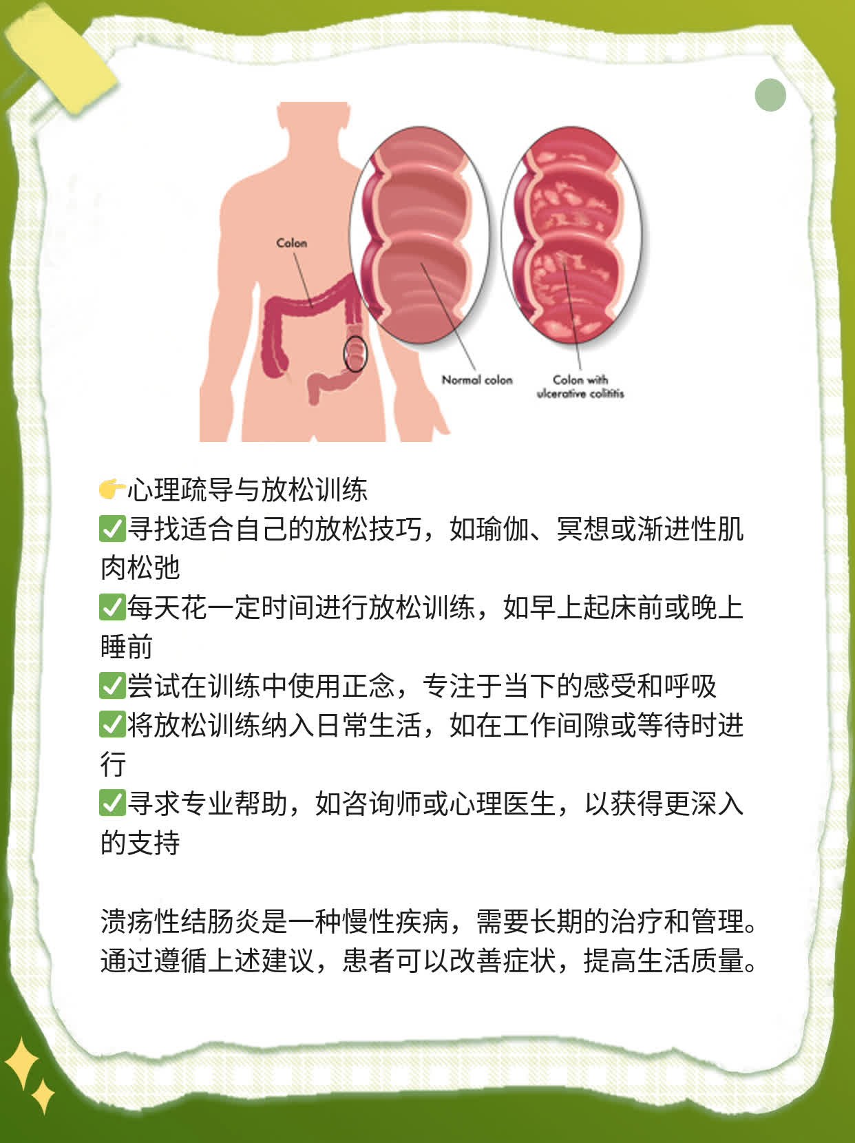 「经验分享」溃疡性结肠炎最佳疗法探秘