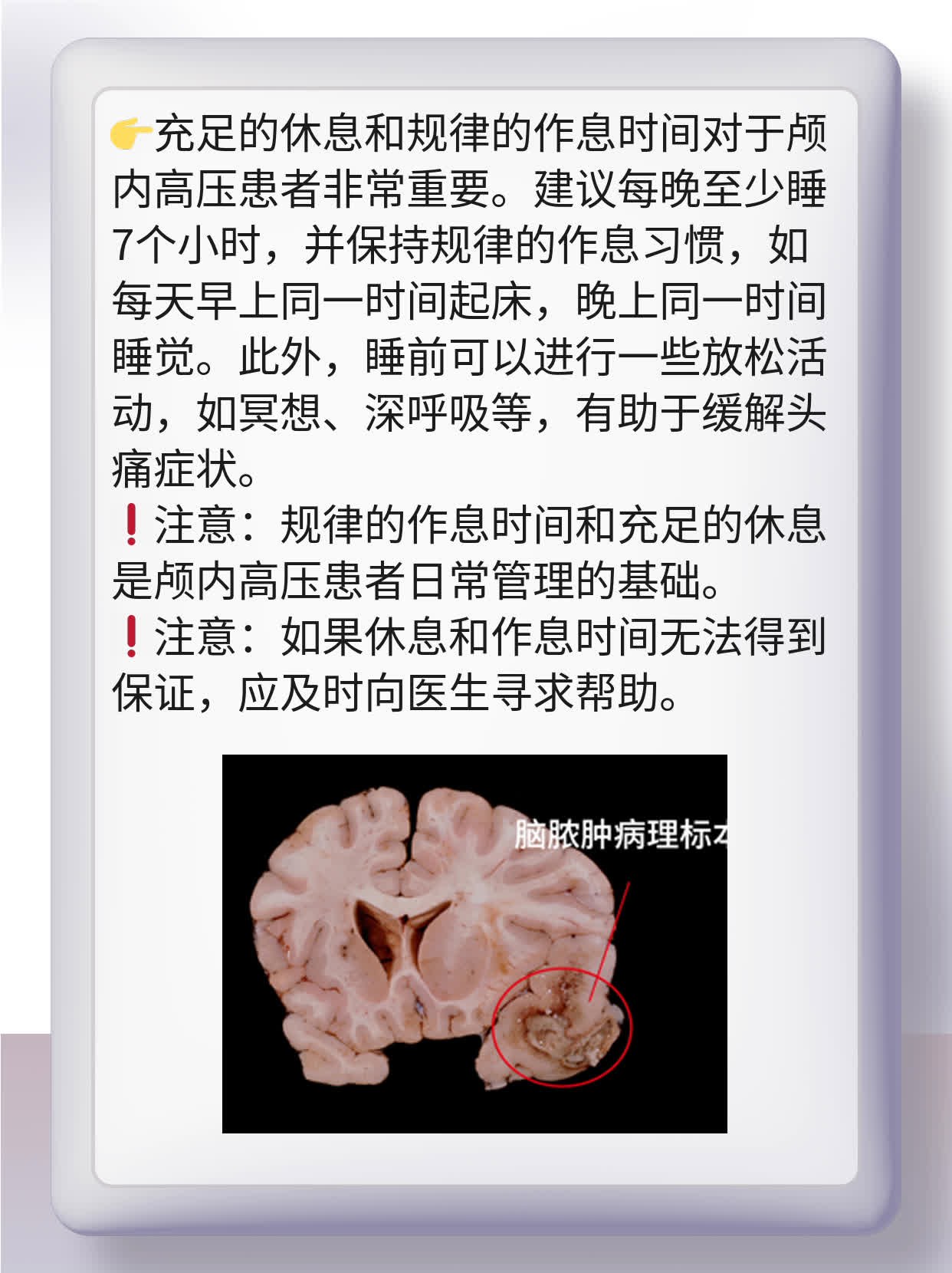 「揭秘」甘露醇脱水机制