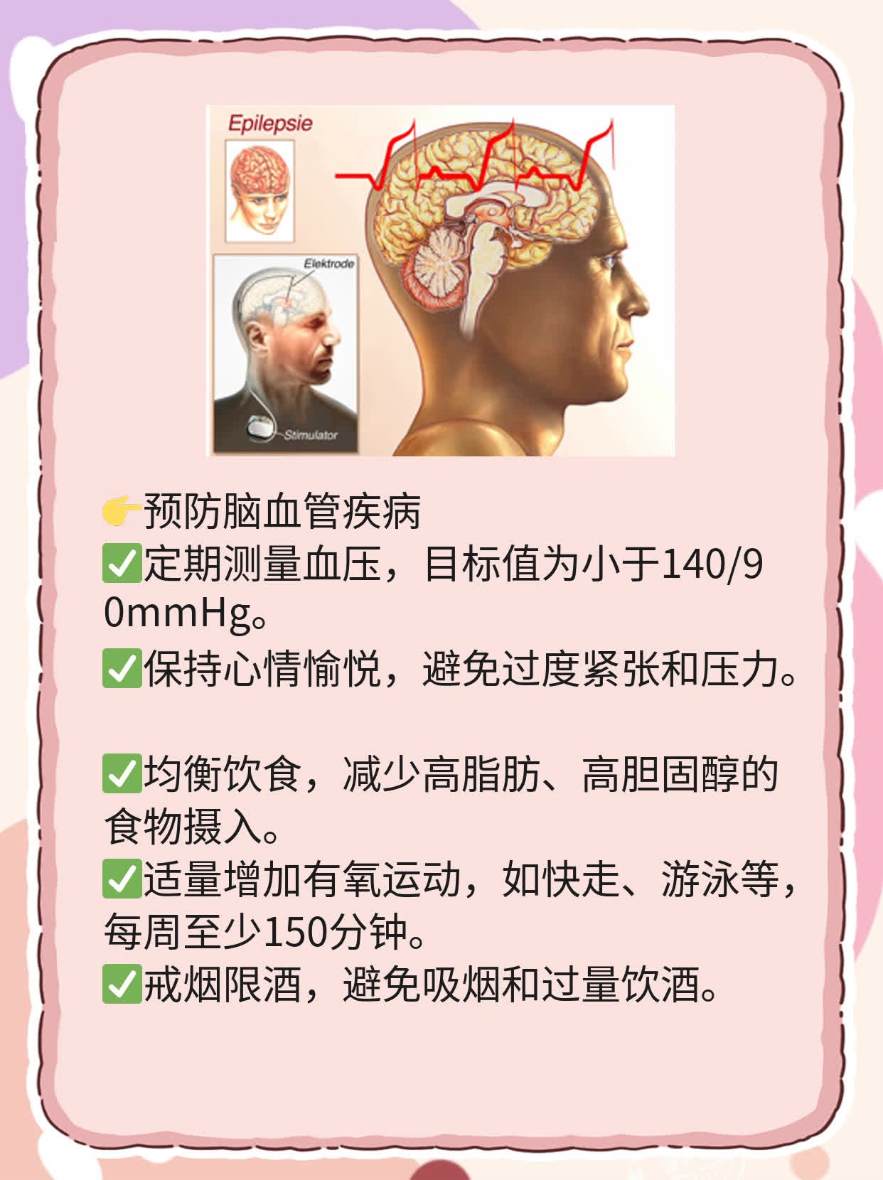 「依达拉奉」作用机制及临床应用分享