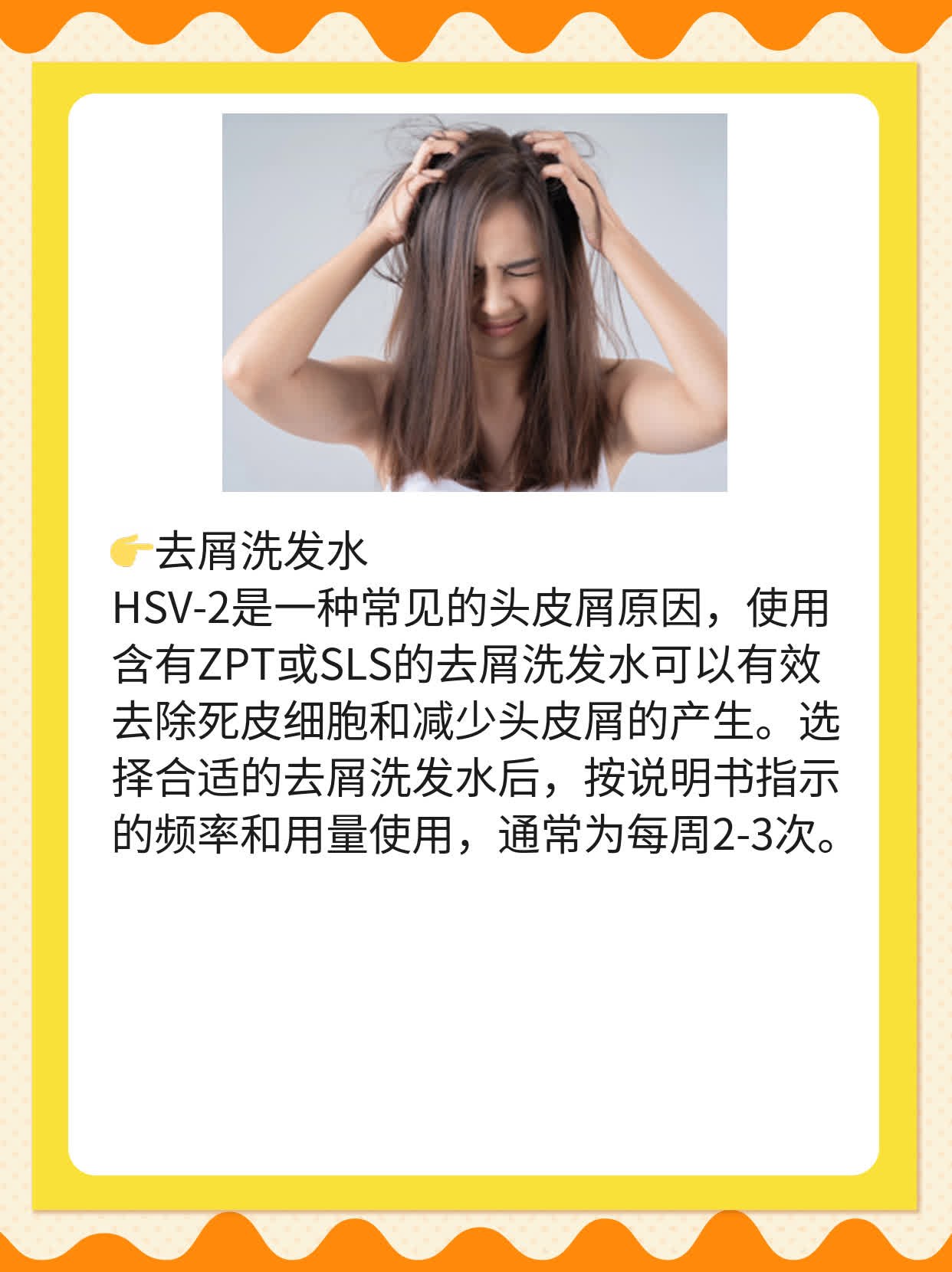 「头皮屑烦恼」：如何摆脱恼人小碎屑？