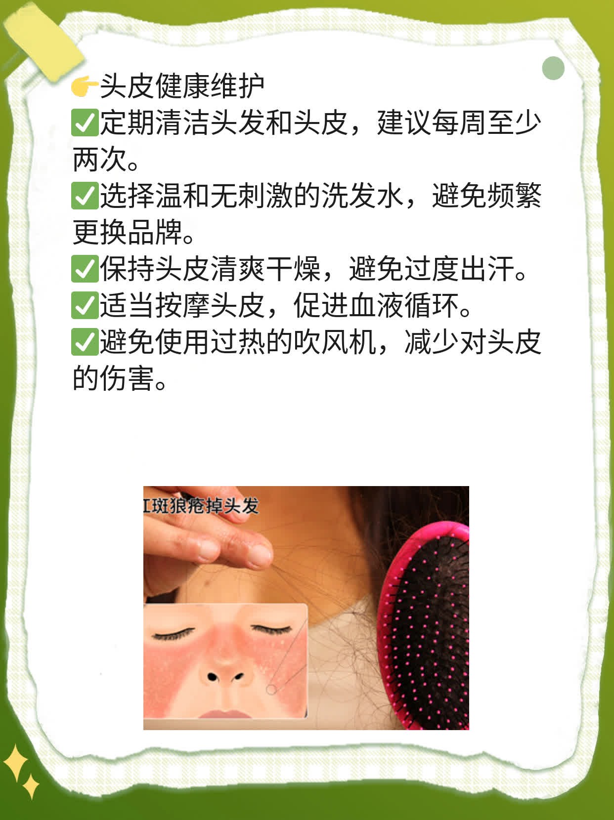 「头皮屑烦恼」：如何摆脱恼人小雪花？