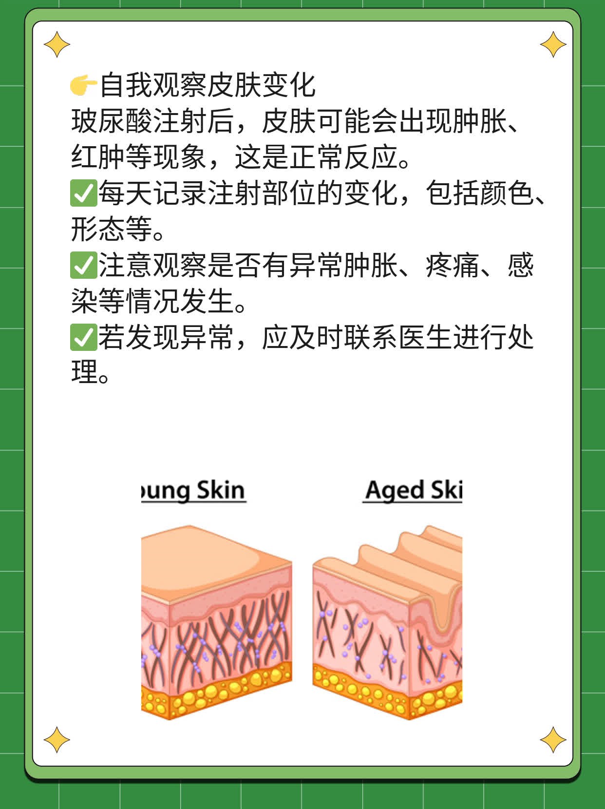 玻尿酸注射攻略：方法与技巧大揭秘！