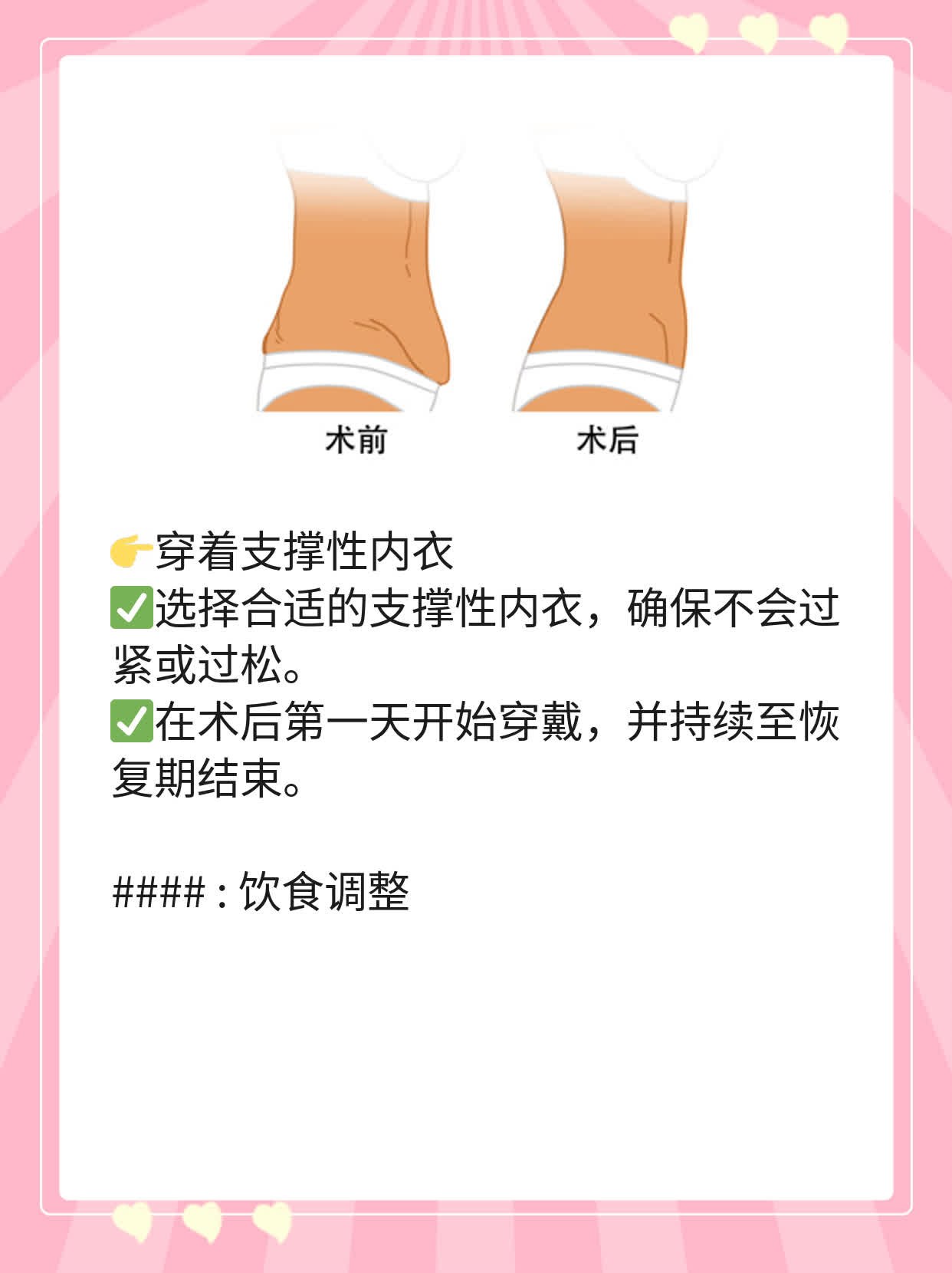 自体脂肪移植隆胸效果如何？探究竟！