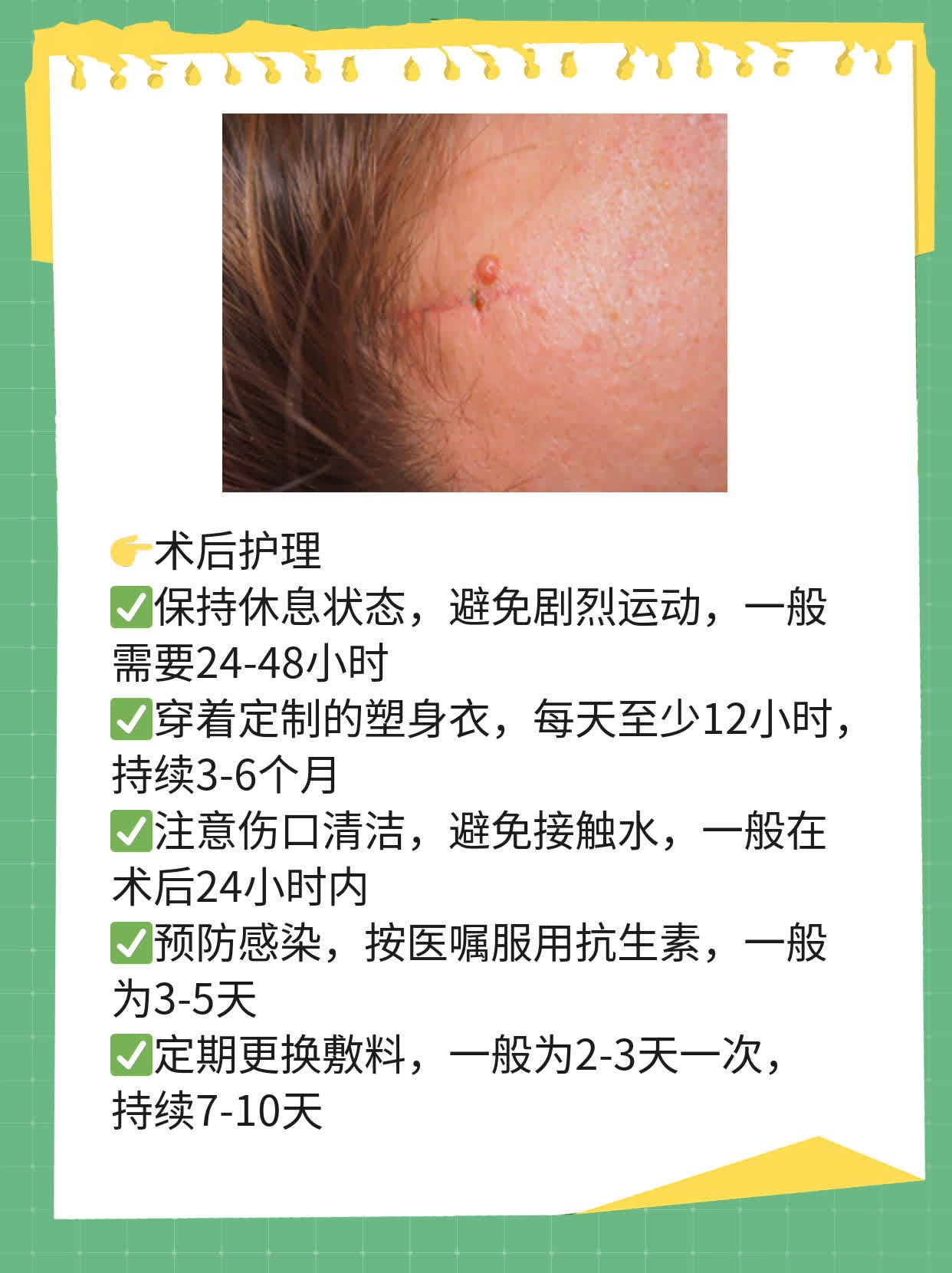 自体脂肪隆胸效果如何？
