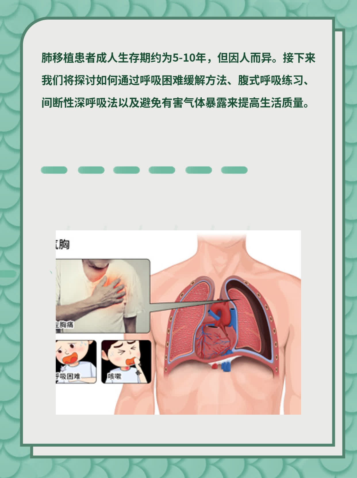 「肺移植后能活几年」：一份关于生存期的探索指南