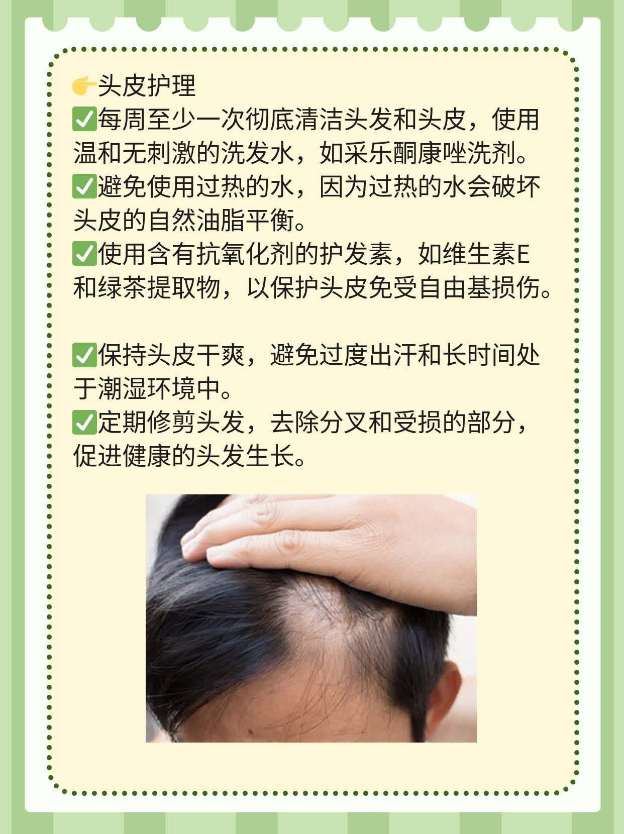 「采乐酮康唑」洗剂长期可用吗？
