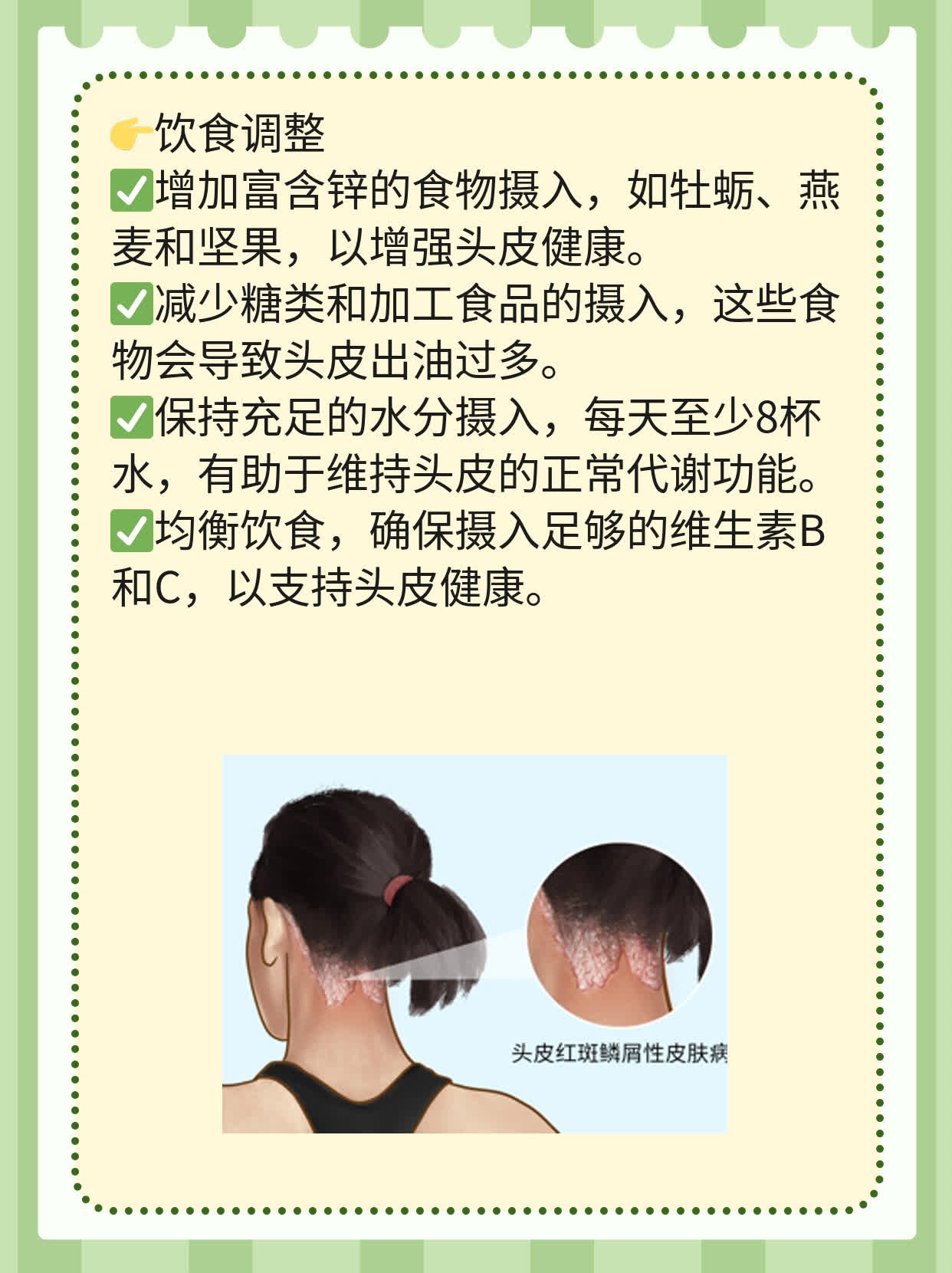 「采乐酮康唑」洗剂长期可用吗？