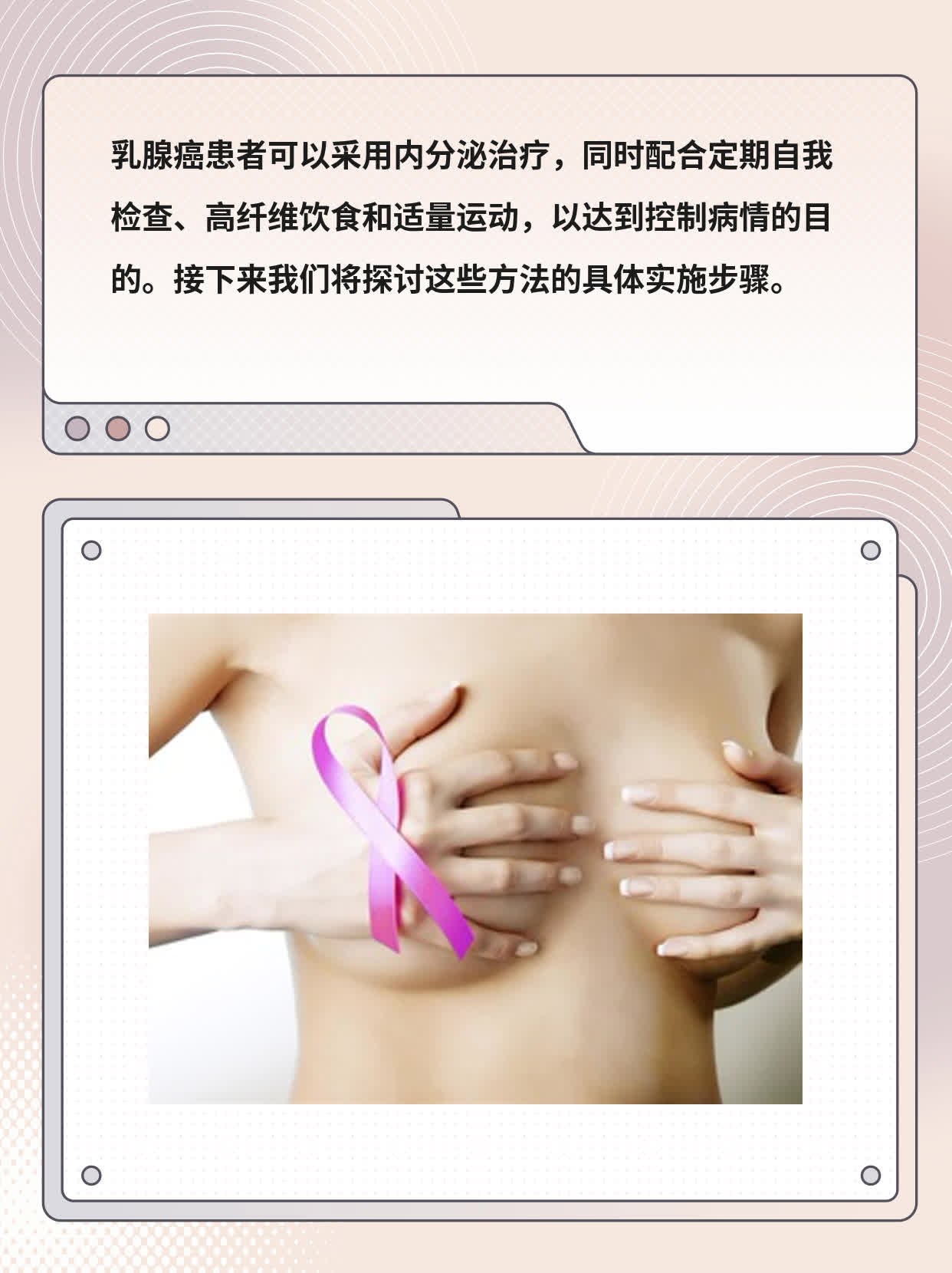 「内分泌治疗」实战指南：乳腺癌患者的必经之路！