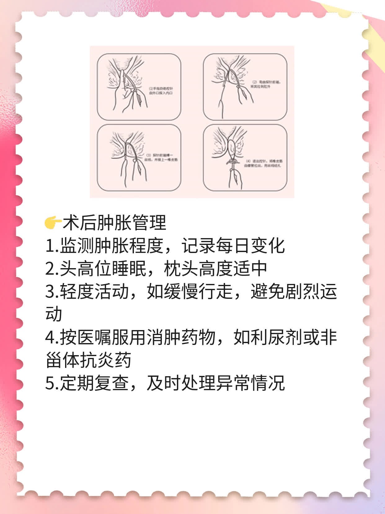 微创面部提升术后护理攻略