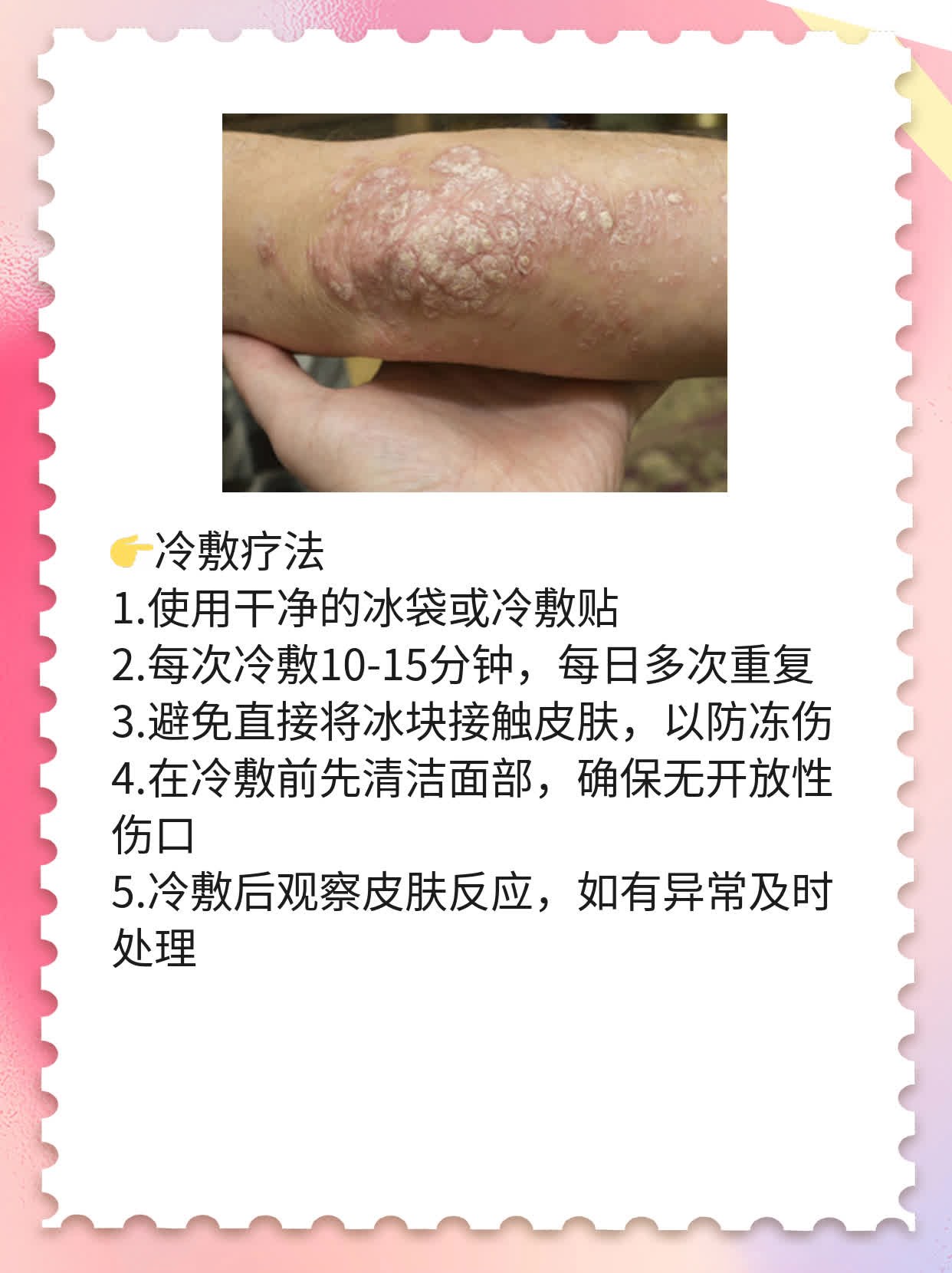 微创面部提升术后护理攻略
