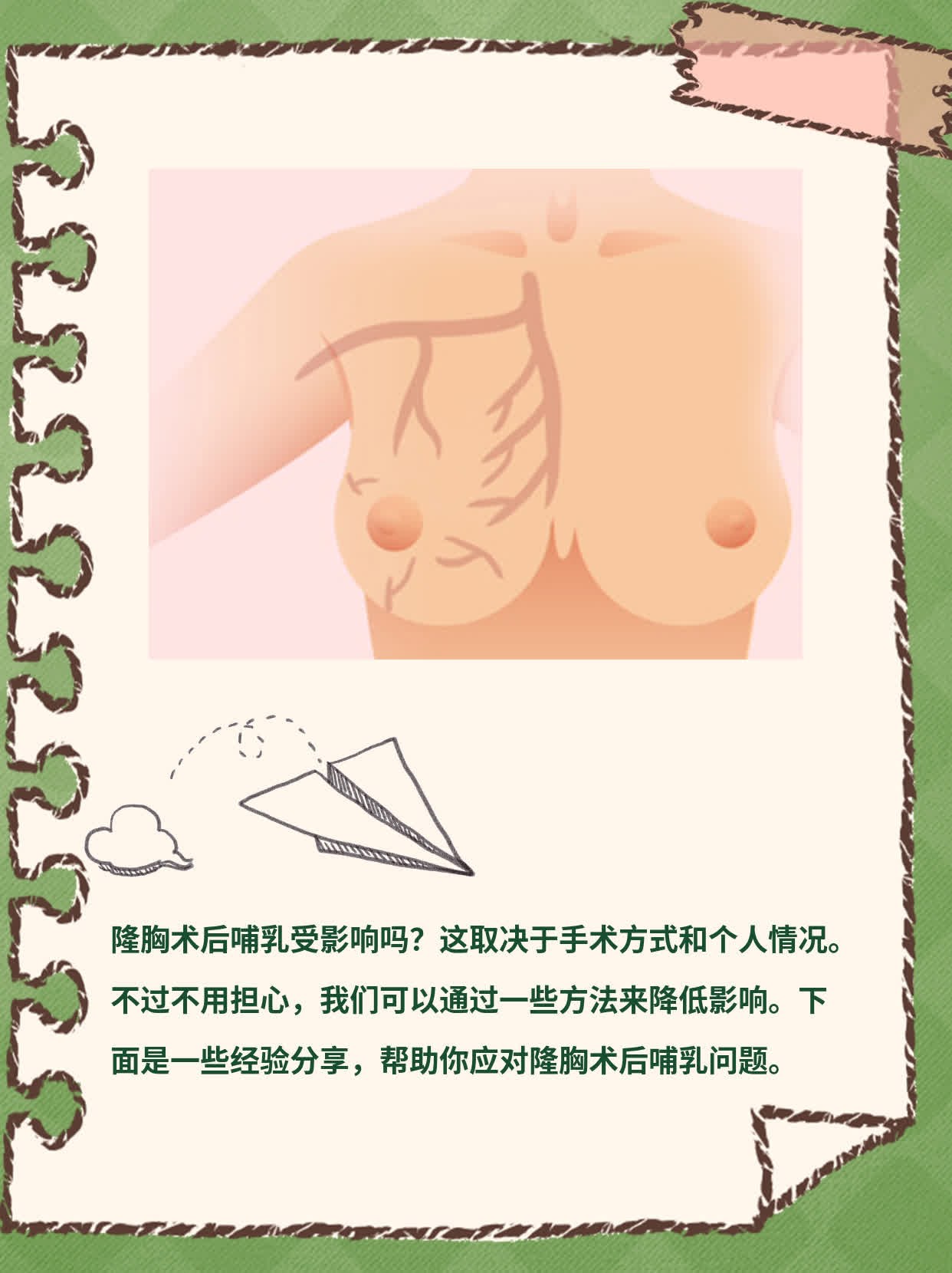 隆胸术后哺乳受影响？经验分享