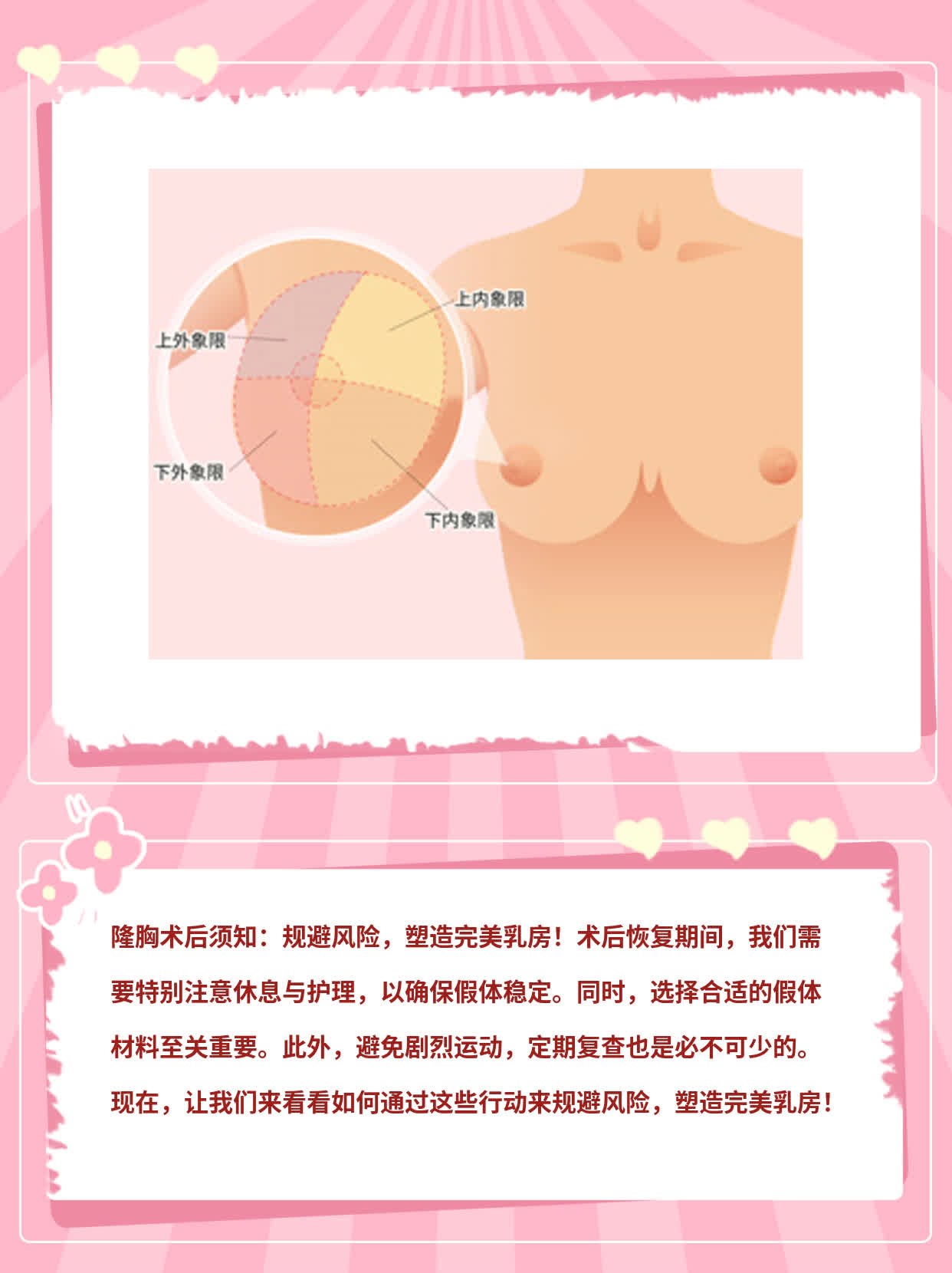 隆胸术后须知：规避风险，塑造完美乳房！