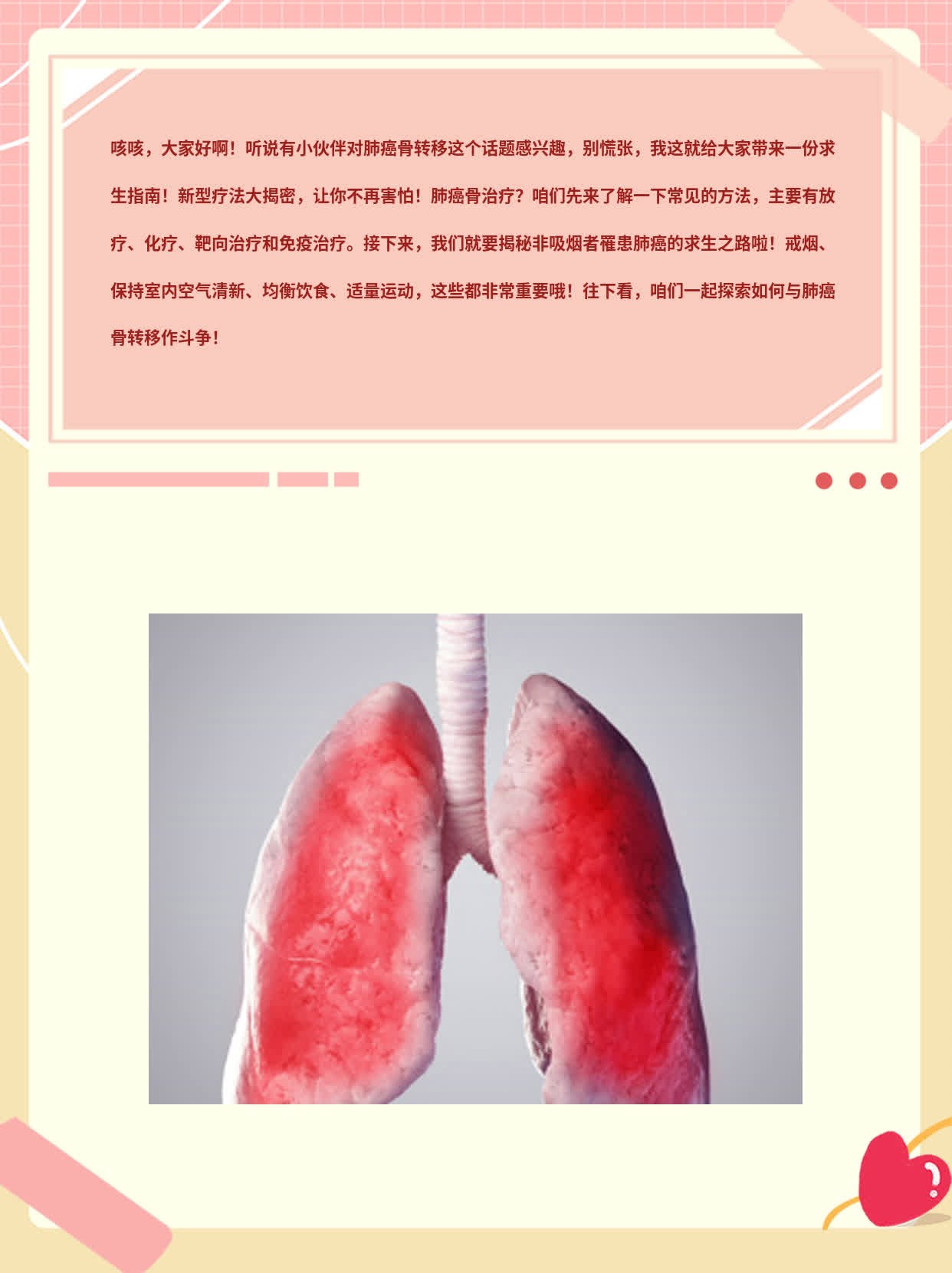 「肺癌骨转移」：揭秘患者求生之路——新型疗法大揭密！