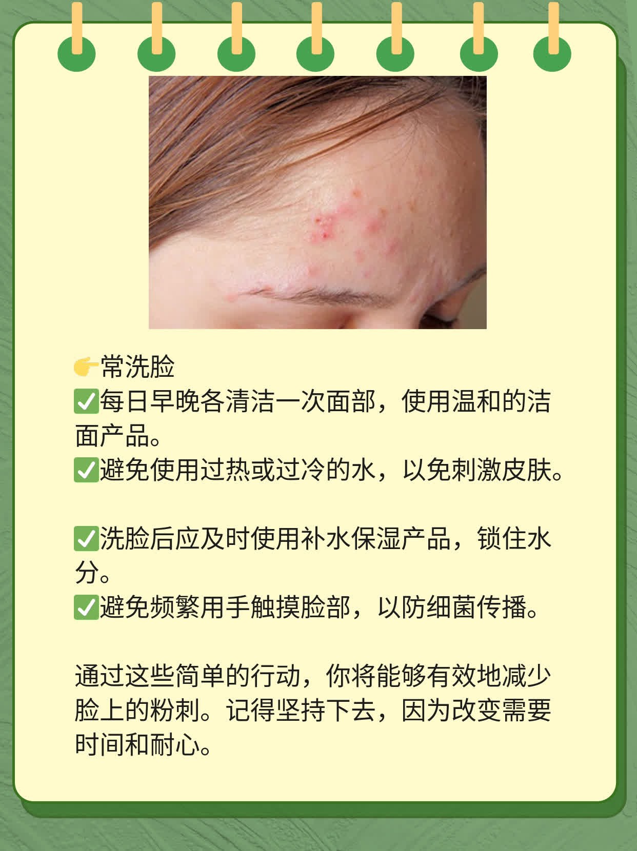 「祛痘大揭秘」：探究脸上粉刺成因及解决之道