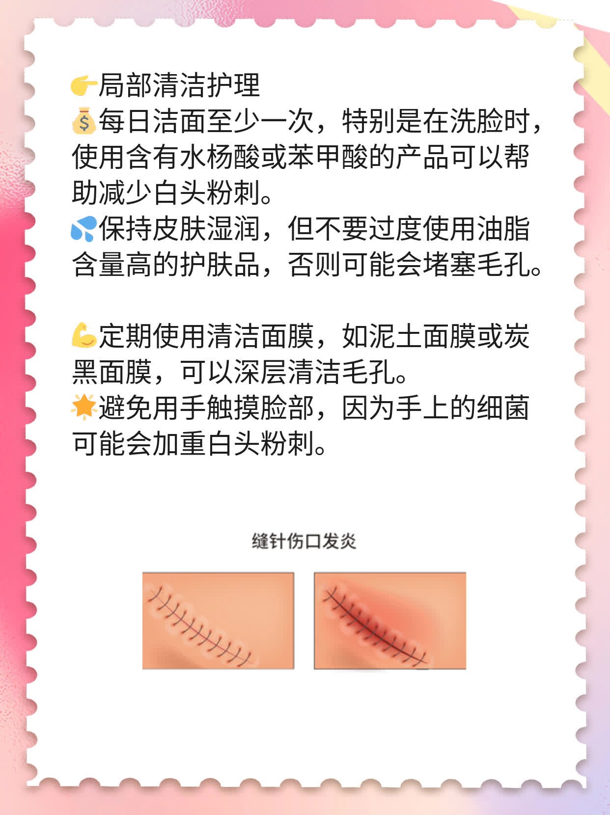 白头粉刺去无踪！快速消除脸上小麻烦的方法大公开！