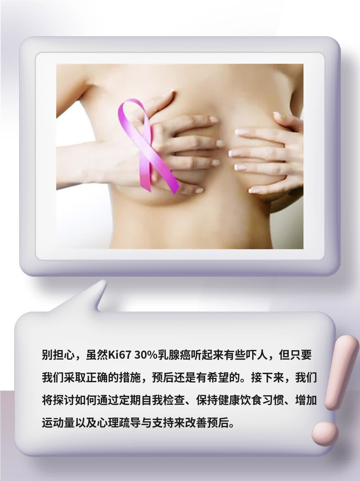 Ki67 30%乳腺癌”：你对预后的担忧是否多余？