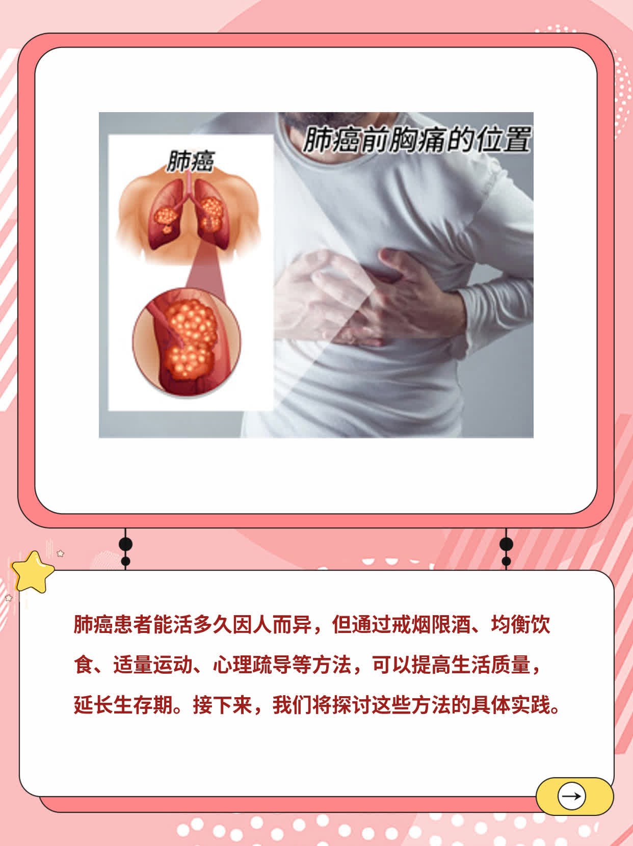「肺癌」：局部晚期肺鳞癌还能「活得久吗？」