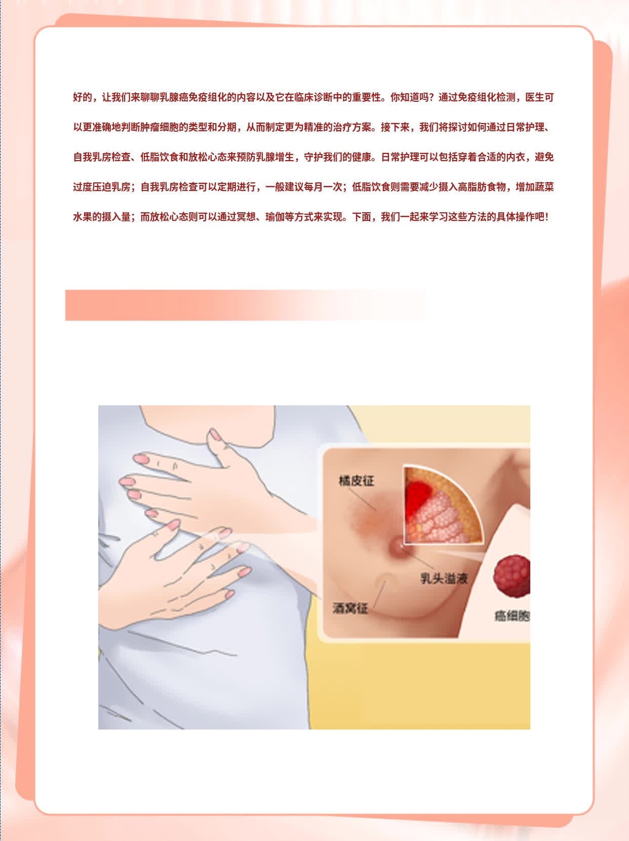 「免疫组化」揭秘：乳腺癌诊断中的关键武器！