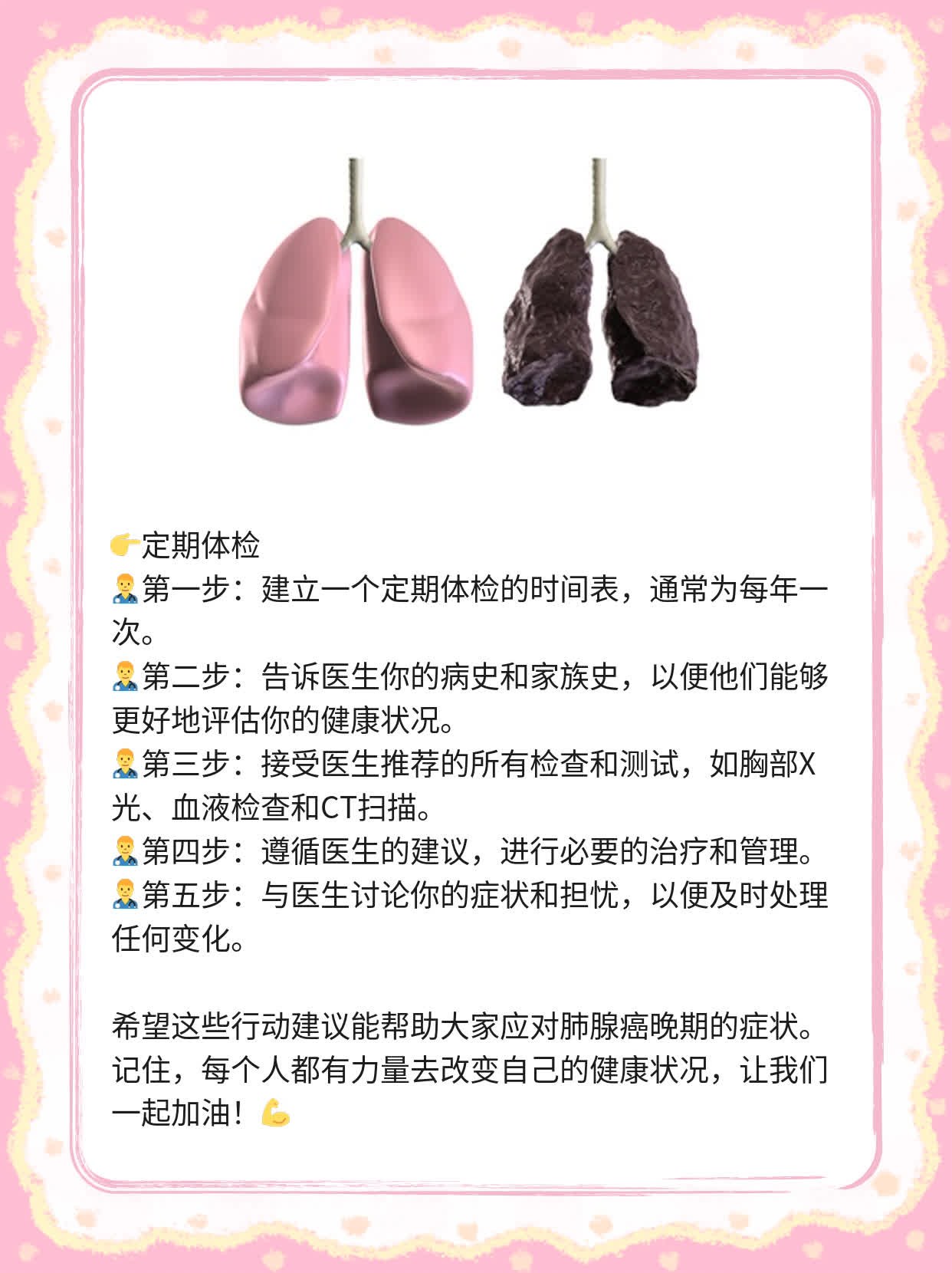 # 肺腺癌晚期：15个预示末期的信号！