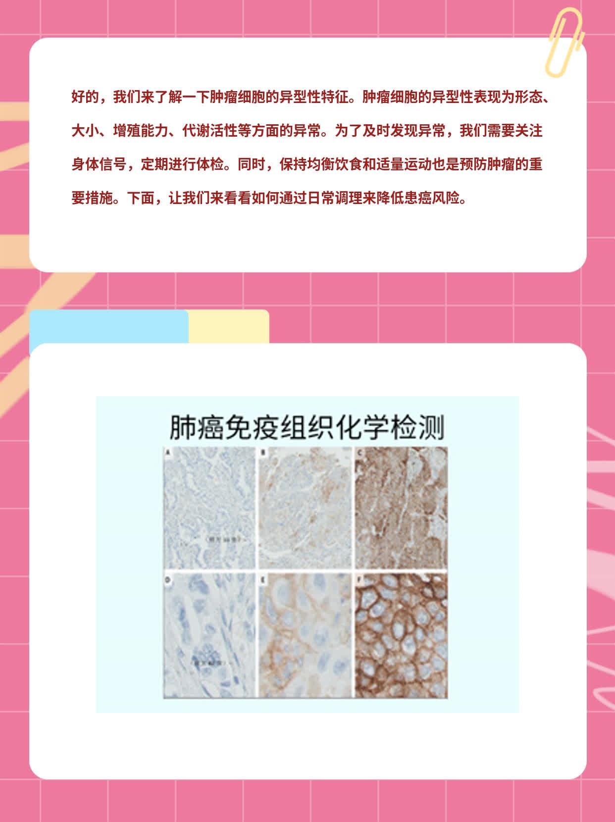 「肿瘤细胞异型性」揭秘：认识异常特征！