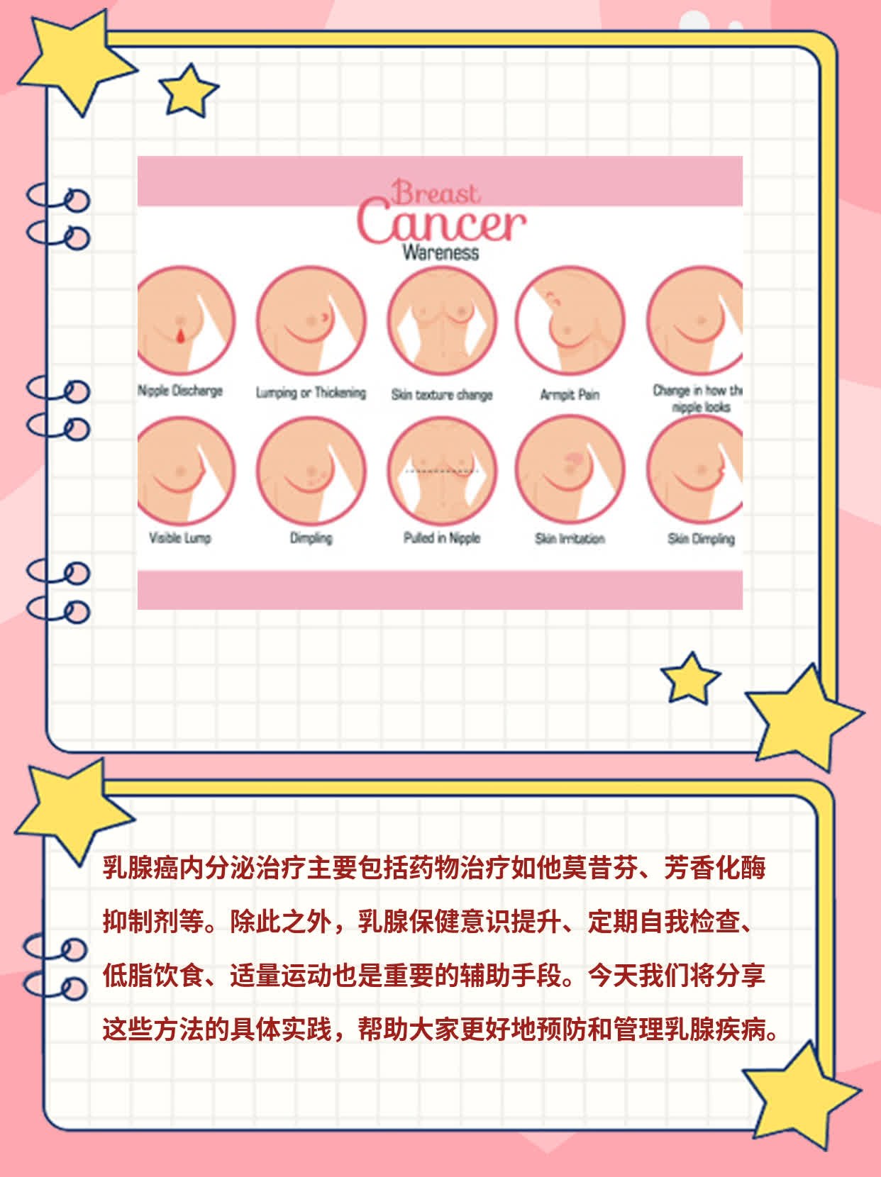 「乳腺癌内分泌治疗」经验分享：方式大盘点！