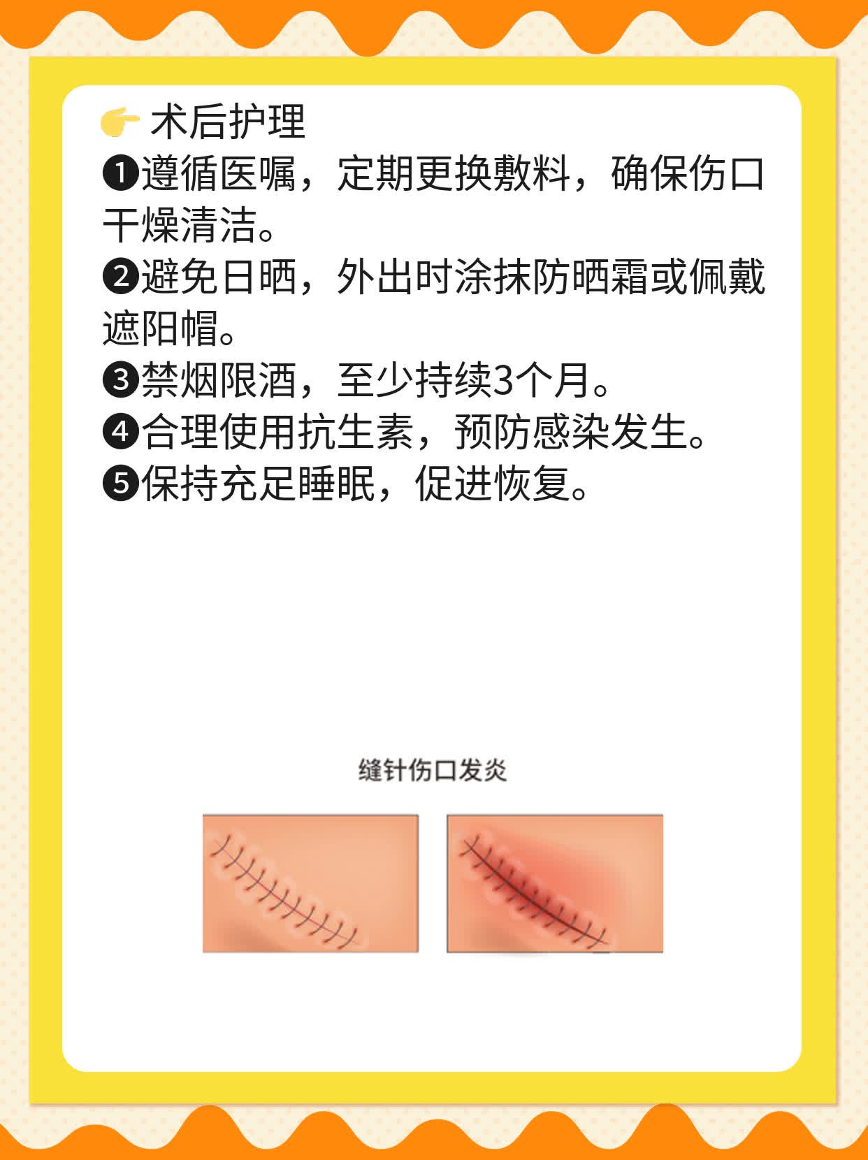 「面部吸脂」真的能「提拉紧致」吗？
