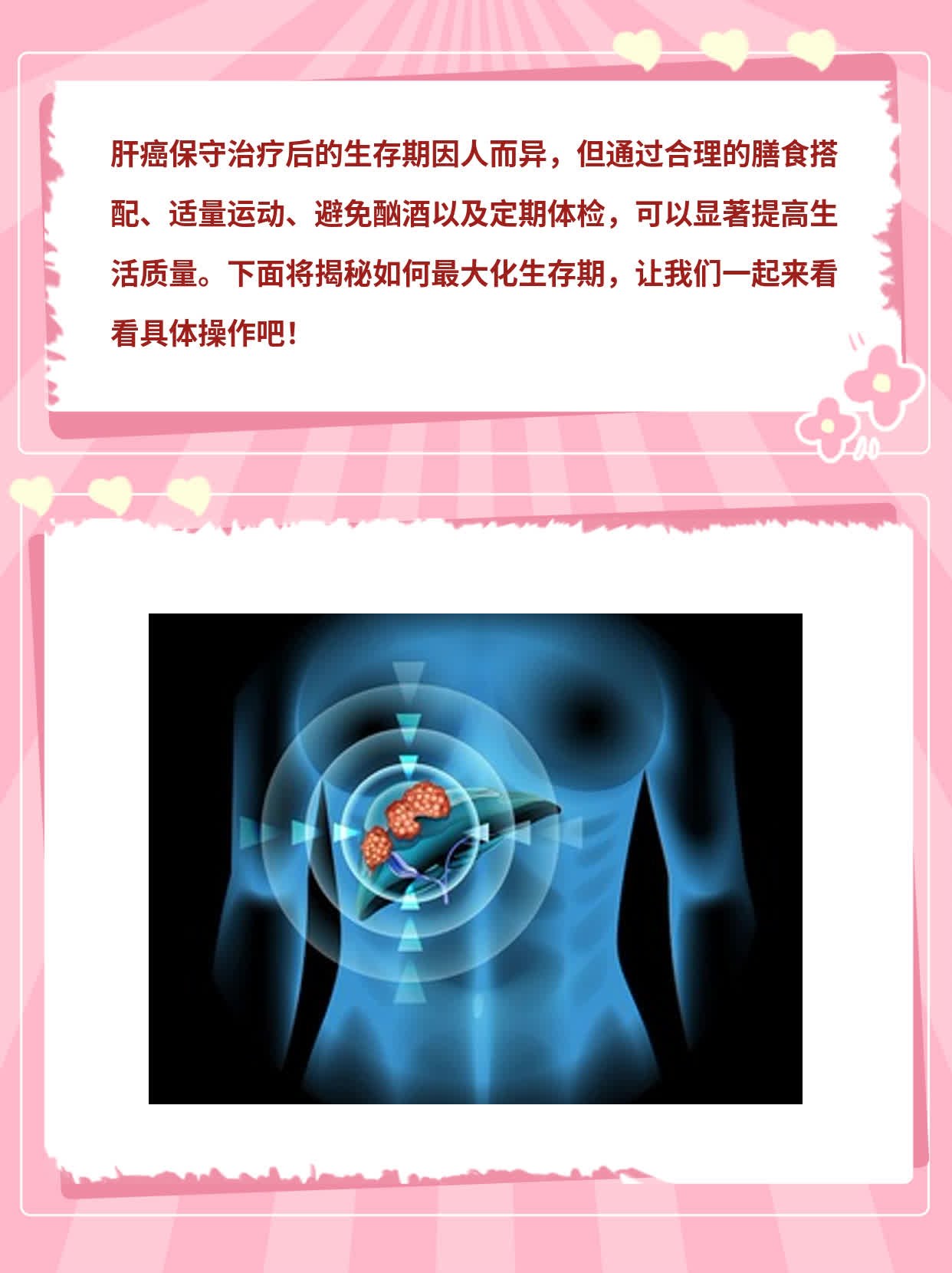 「肝癌保守治疗」后的生存期探秘