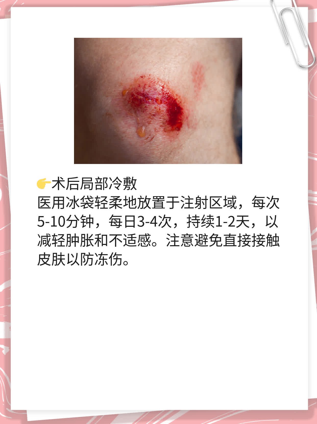 揭秘面部脂肪填充：它算不算矫形手术？