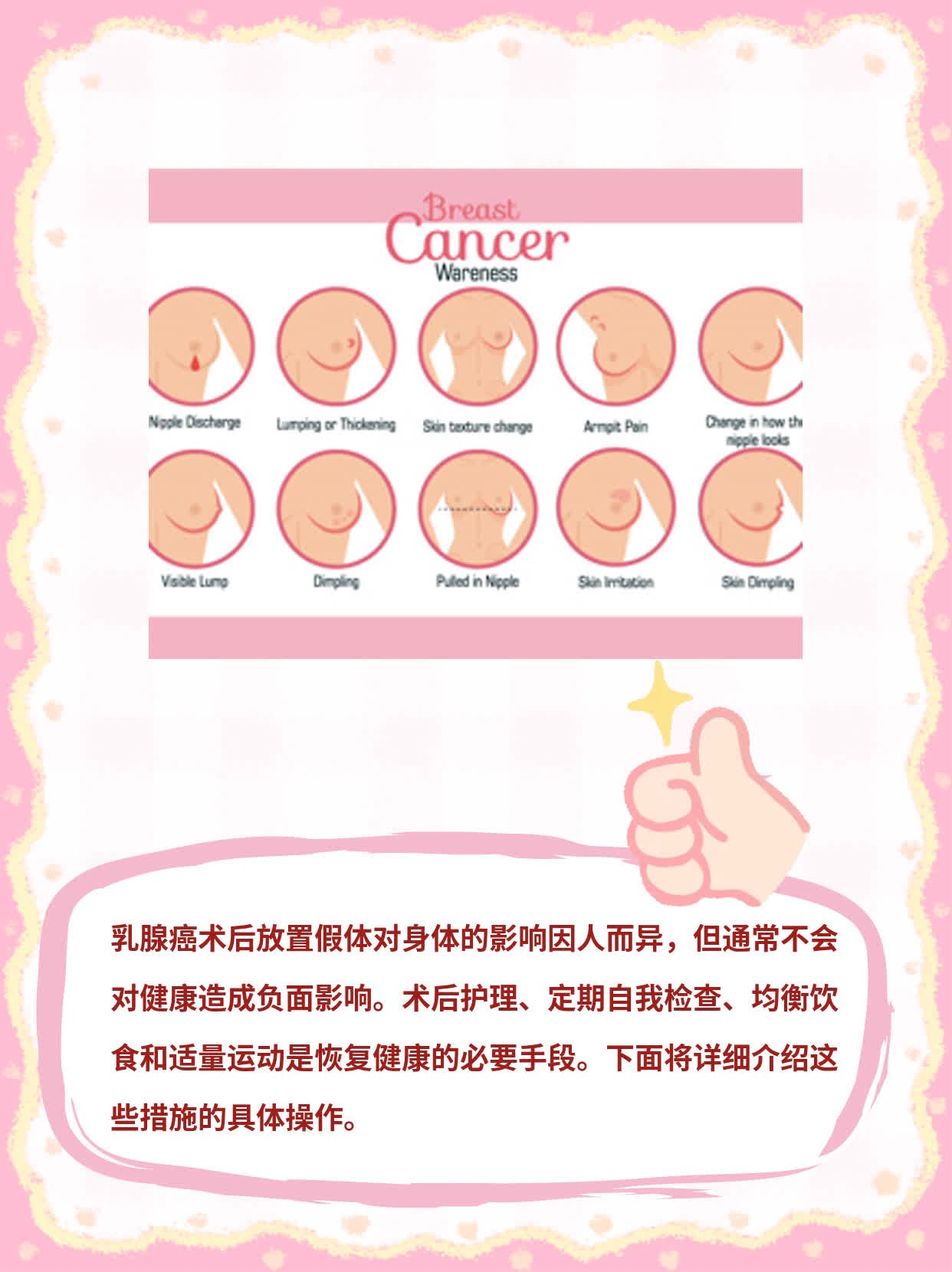 「有假体的乳腺癌术后」对身体好吗？