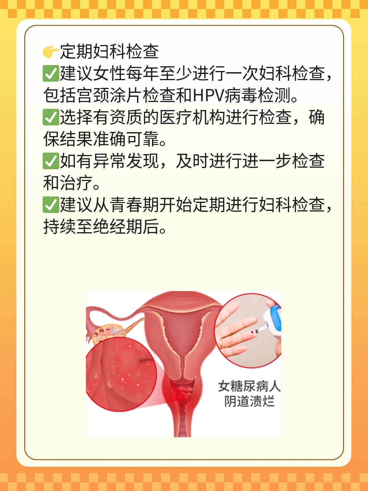 「宫颈癌4价疫苗」接种年龄你知道吗？