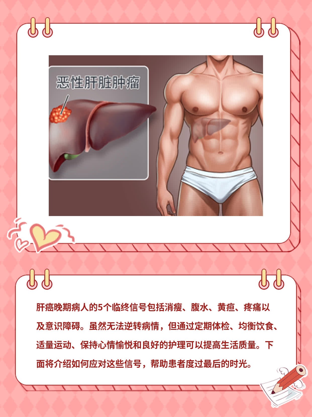 识别肝癌晚期病人的5个临终信号