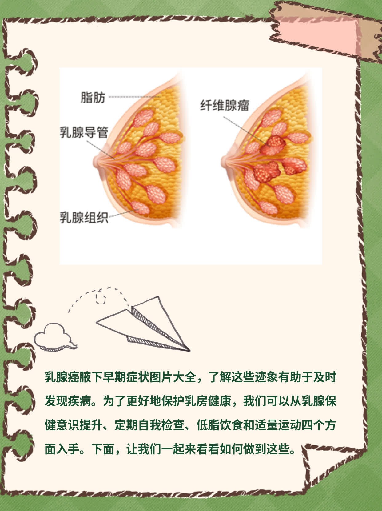 「看懂」乳腺癌腋下初发迹象：图解大全