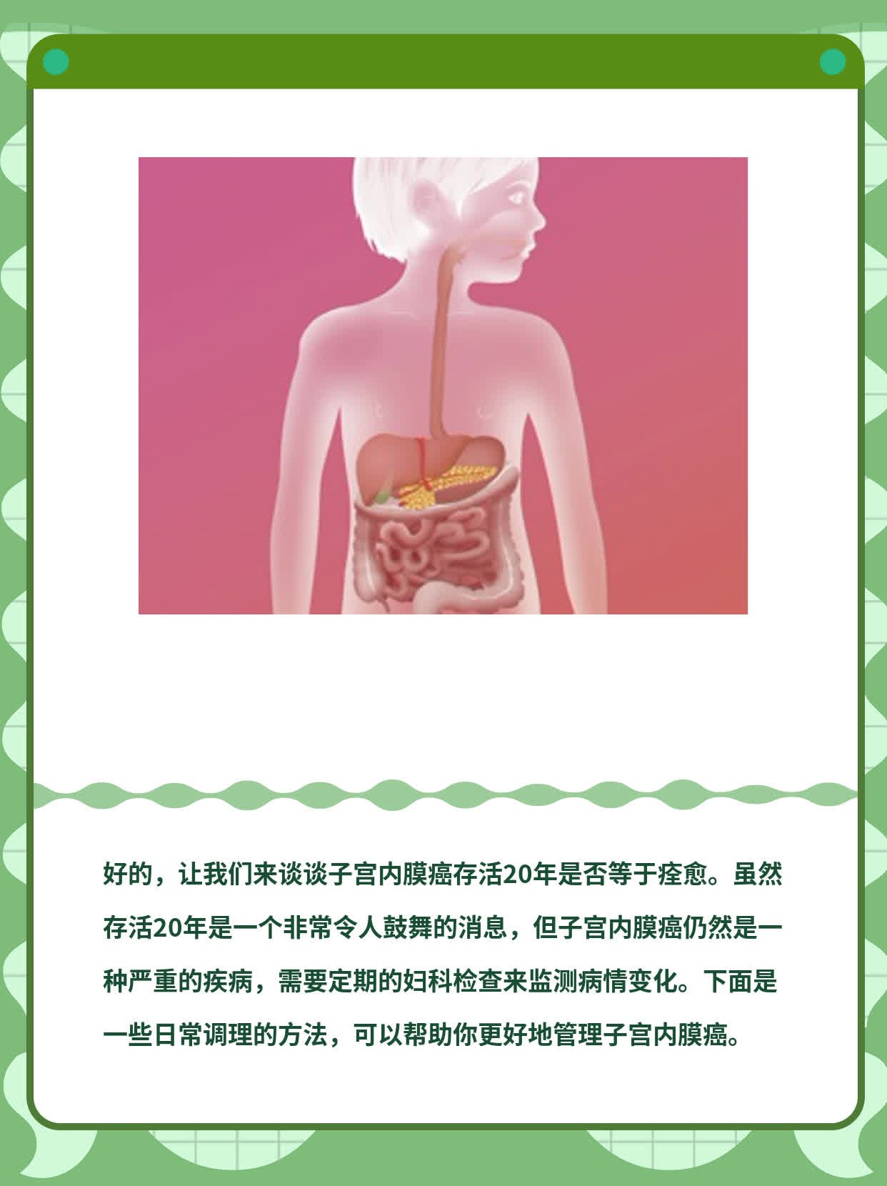 「分享」子宫内膜癌存活20年=痊愈？