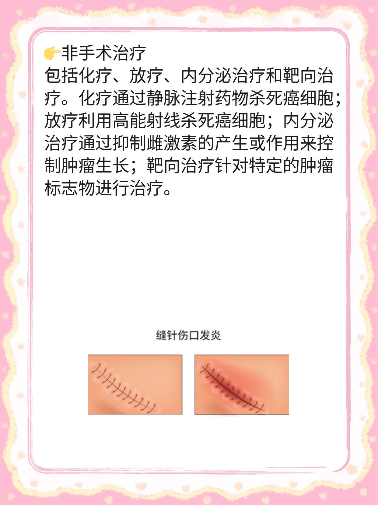 认识乳腺癌：早期症状大盘点！