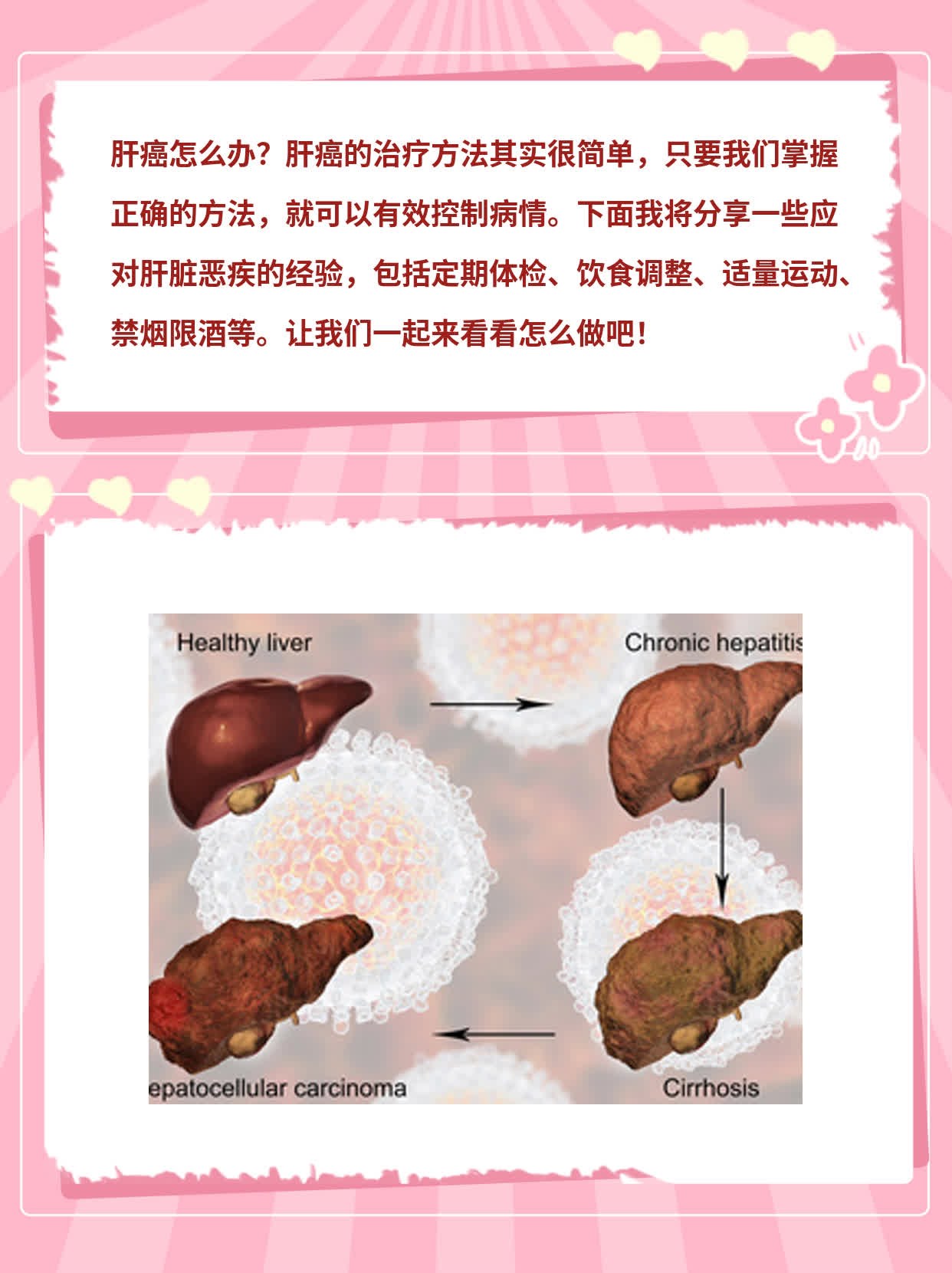 「肝癌治疗」经验分享：如何应对肝脏恶疾？