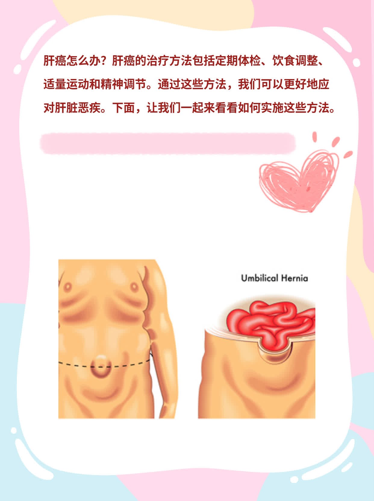 「肝癌治疗」经验分享：如何应对肝脏恶疾？