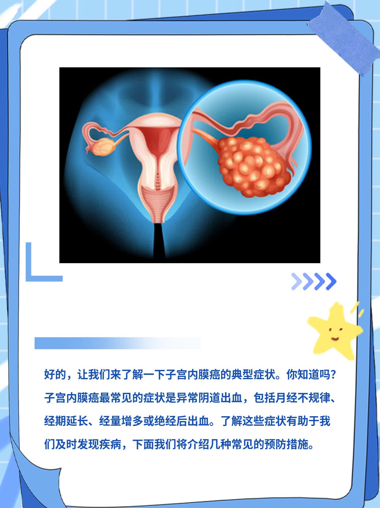 「分享」子宫内膜癌典型症状，你知道几个？