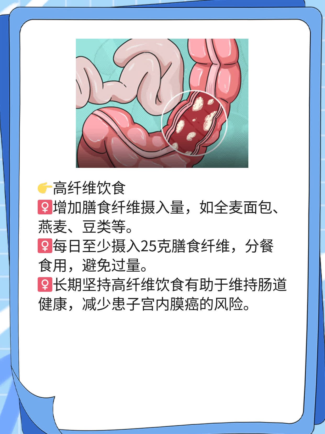 「分享」子宫内膜癌典型症状，你知道几个？